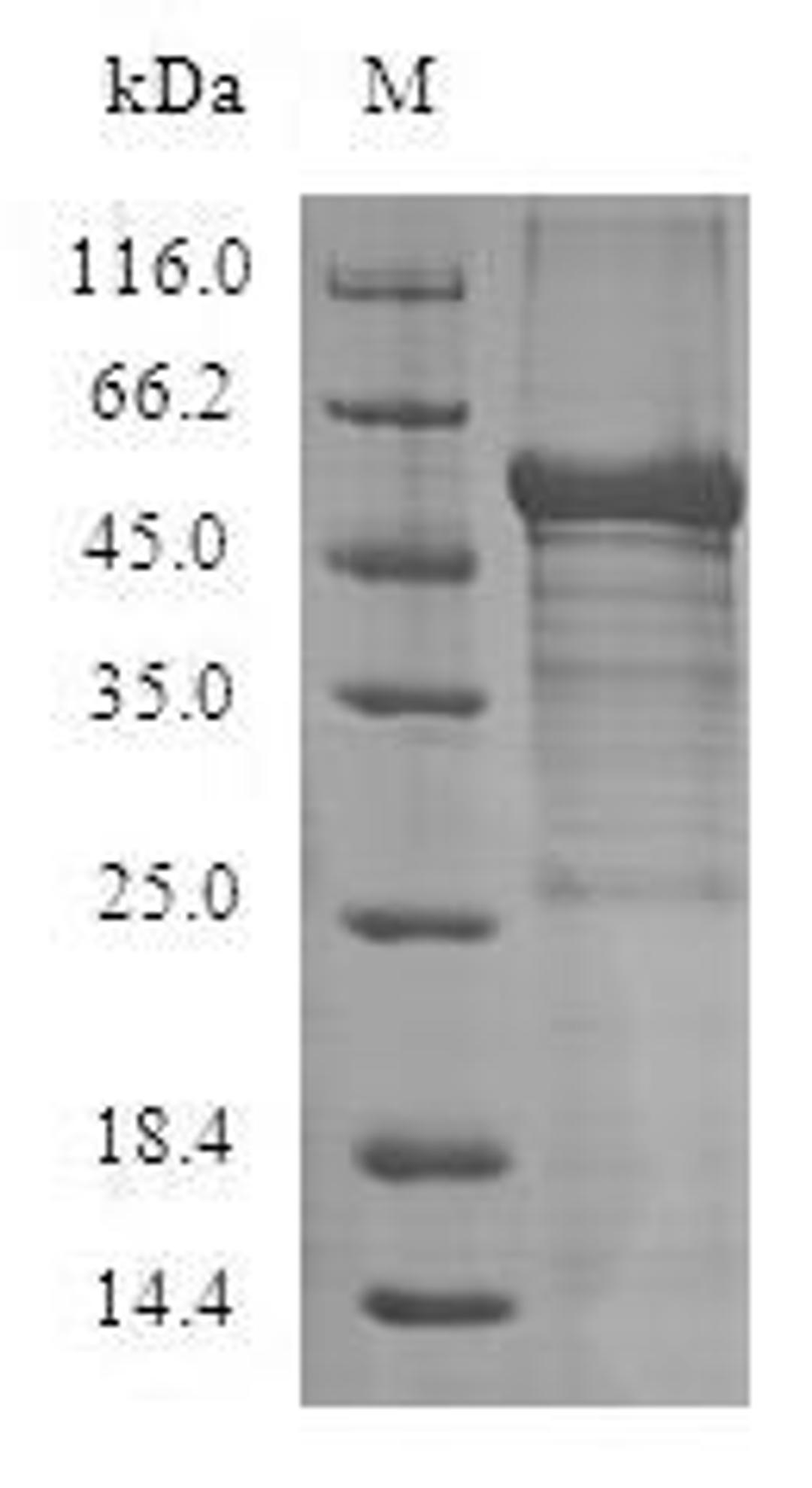 (Tris-Glycine gel) Discontinuous SDS-PAGE (reduced) with 5% enrichment gel and 15% separation gel.