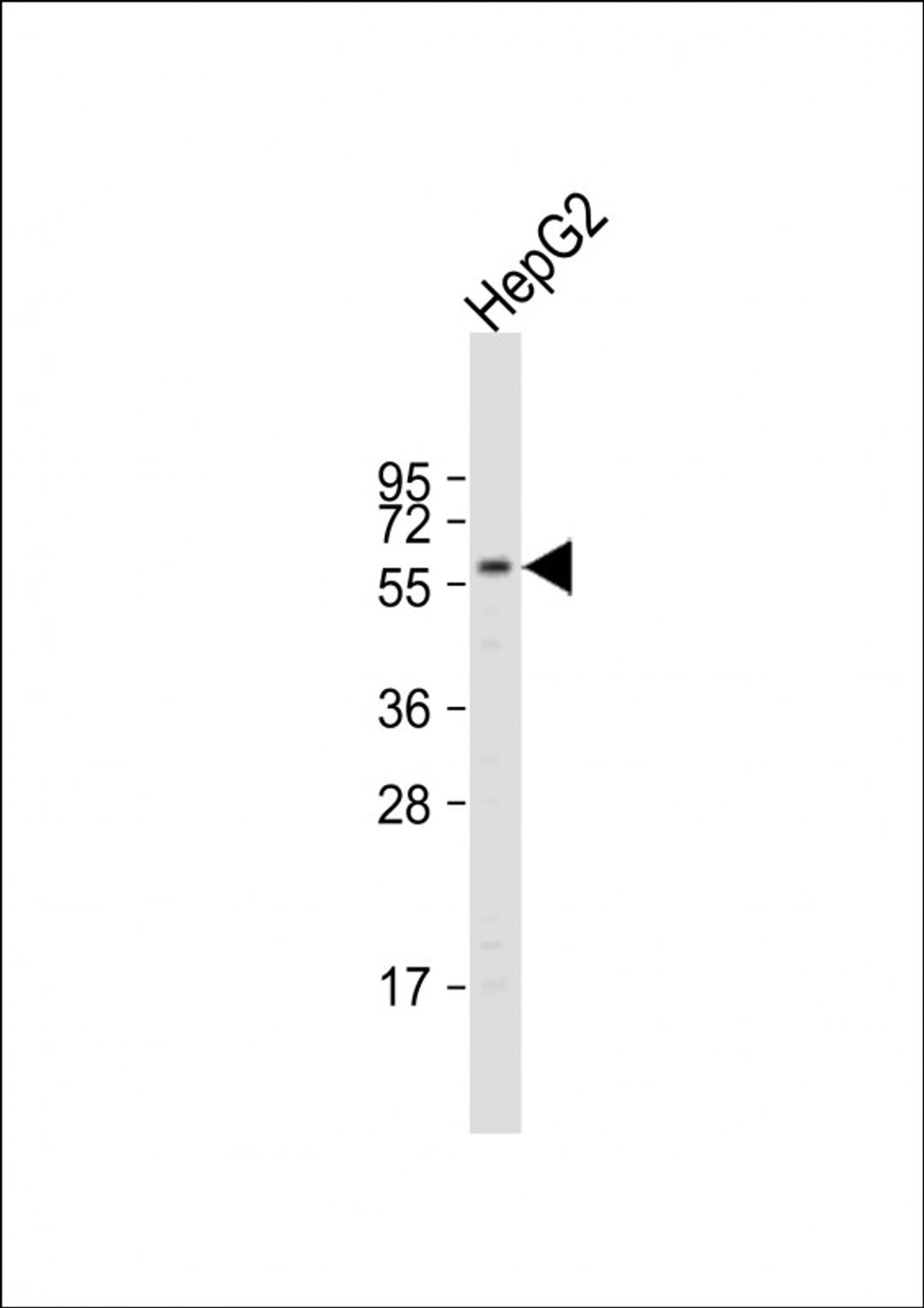 Western Blot at 1:1000 dilution + HepG2 whole cell lysate Lysates/proteins at 20 ug per lane.