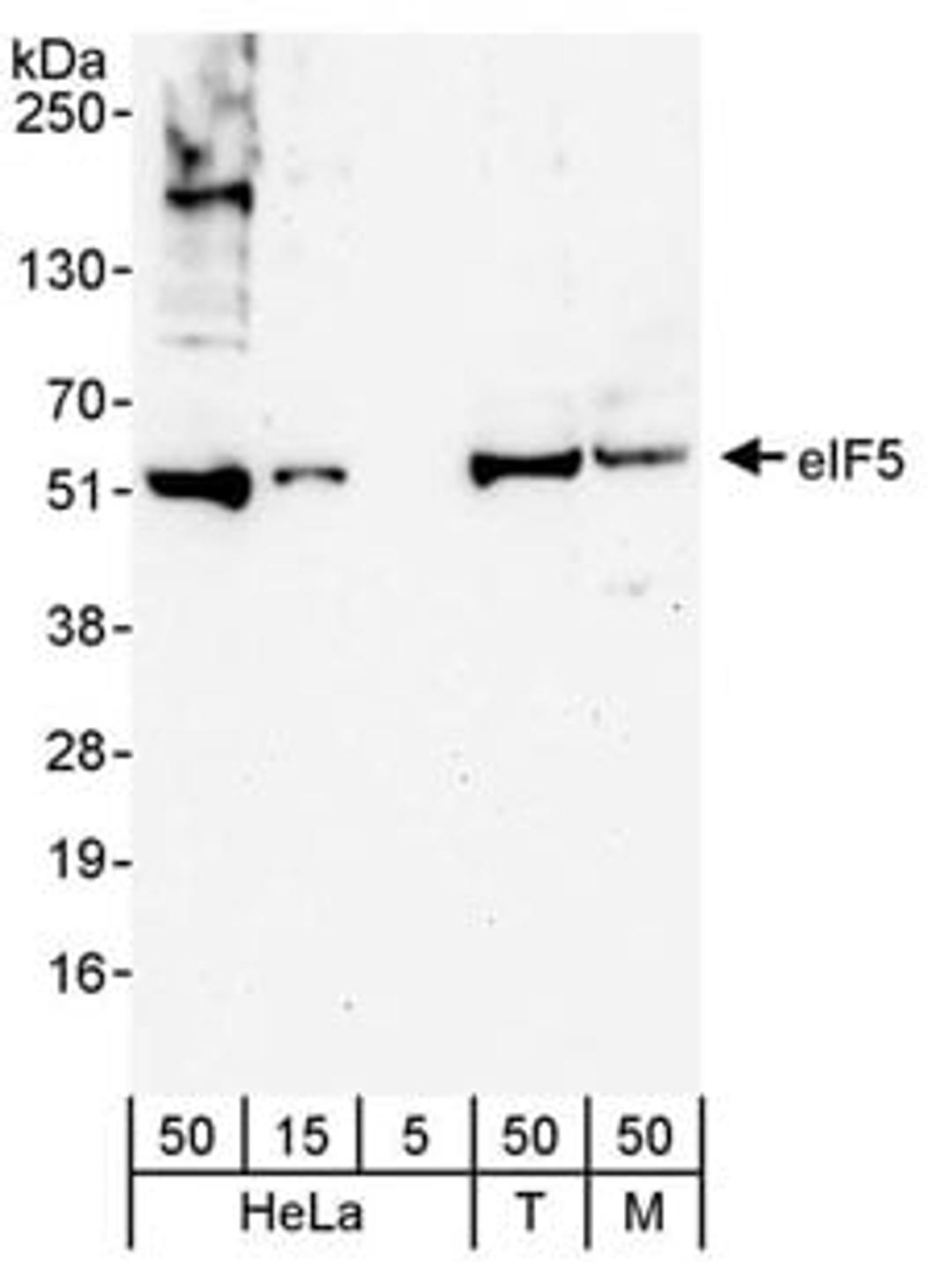 Detection of human and mouse eIF5 by western blot.