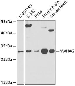 Western blot - YWHAG antibody (A3043)