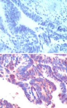 Immunohistochemistry-Paraffin: IFRD1 Antibody [NBP2-24679] - Immunohistochemical analysis of IFRD1 in formalin-fixed, paraffin-embedded humanrectum tissue using an isotype control (top) and NBP2-24679 (bottom) at 5 ug/ml.