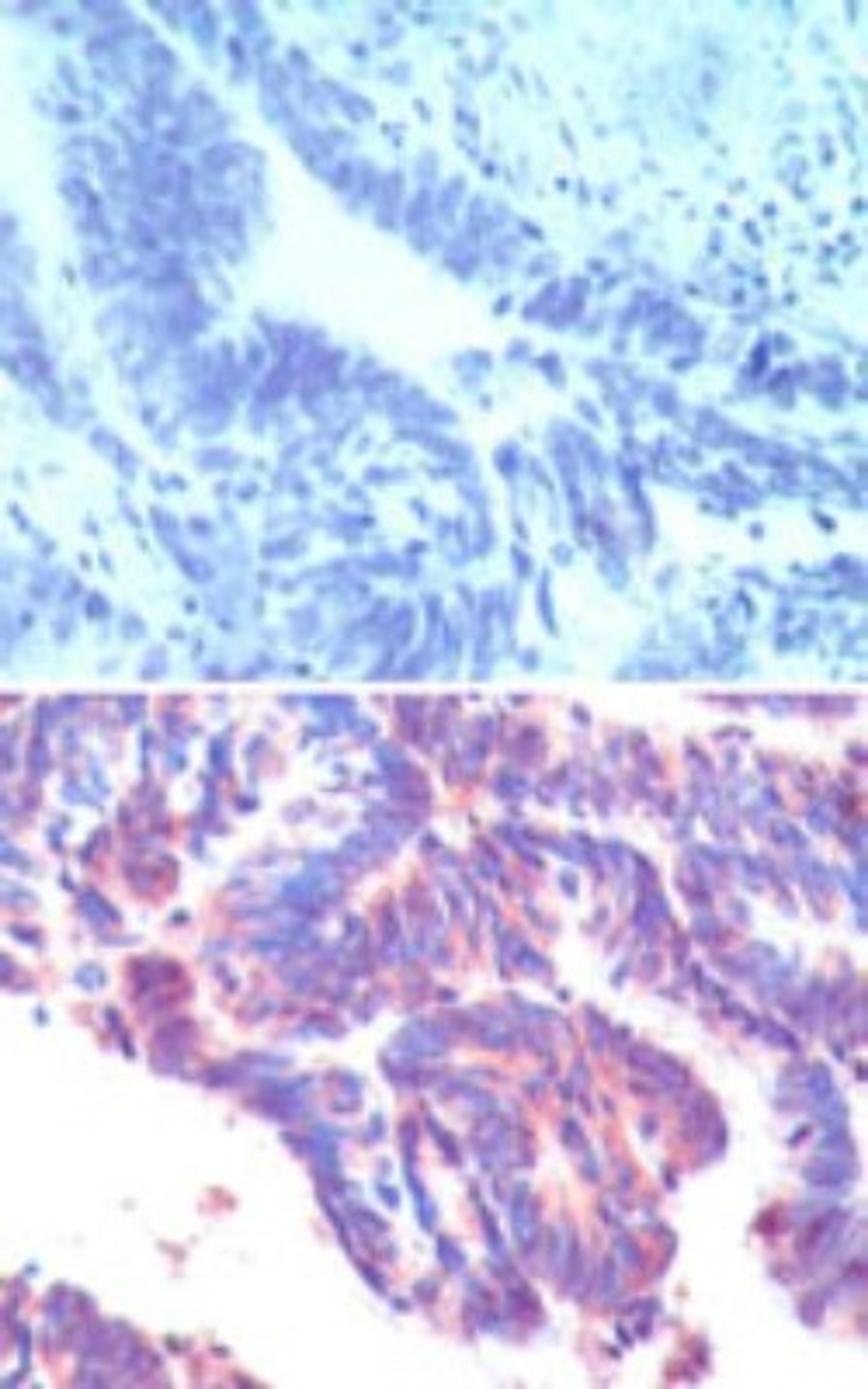 Immunohistochemistry-Paraffin: IFRD1 Antibody [NBP2-24679] - Immunohistochemical analysis of IFRD1 in formalin-fixed, paraffin-embedded humanrectum tissue using an isotype control (top) and NBP2-24679 (bottom) at 5 ug/ml.