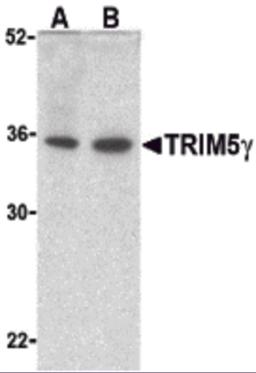 Western blot analysis of TRIM5 gamma expression in human bladder (A) and colon (B) cell lysate with TRIM5 gamma antibody at 2 &#956;g /ml.