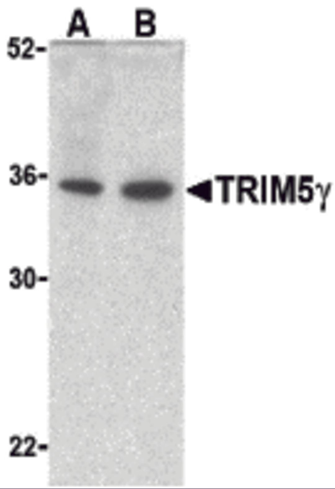 Western blot analysis of TRIM5 gamma expression in human bladder (A) and colon (B) cell lysate with TRIM5 gamma antibody at 2 μg /ml.