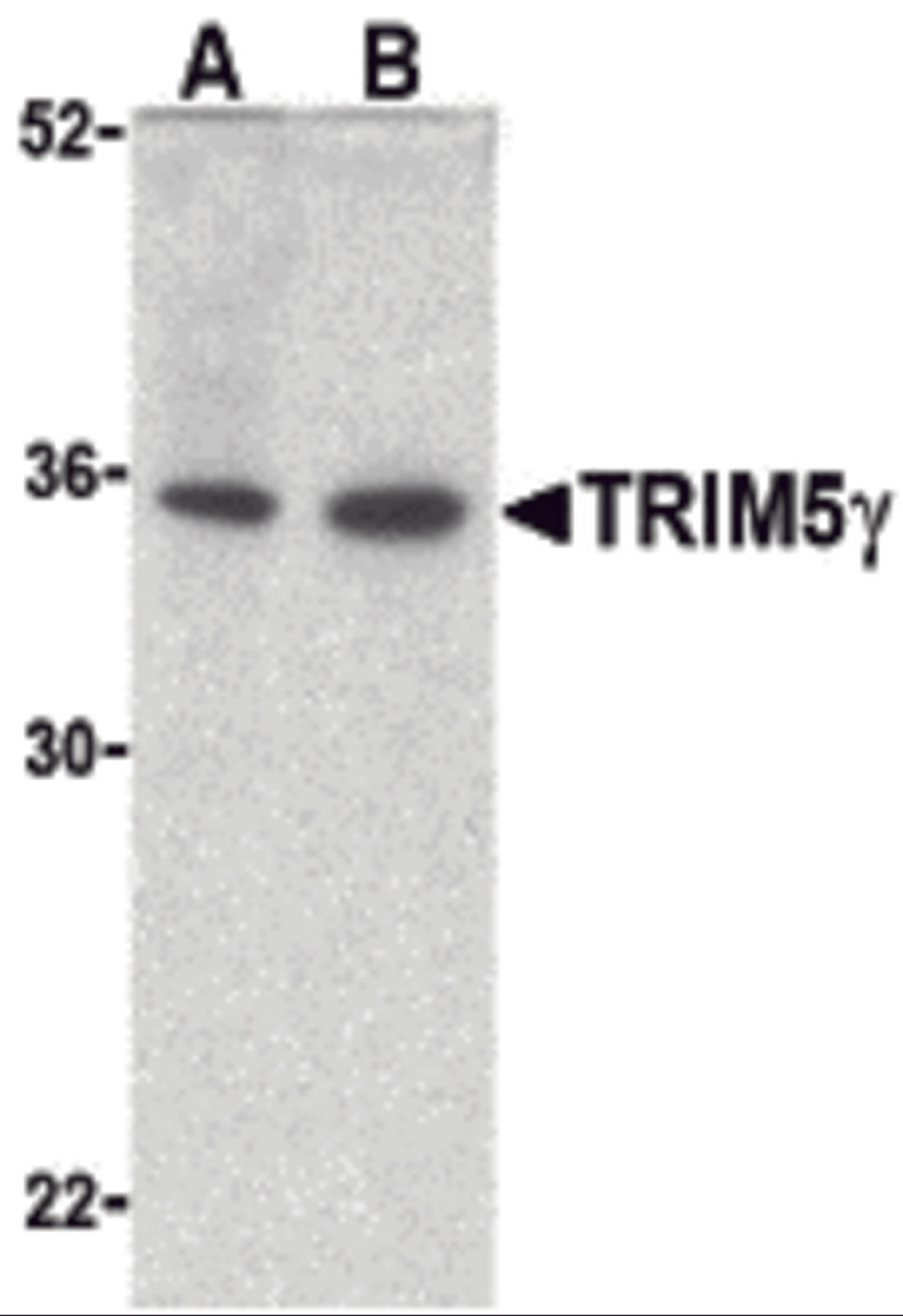 Western blot analysis of TRIM5 gamma expression in human bladder (A) and colon (B) cell lysate with TRIM5 gamma antibody at 2 μg /ml.