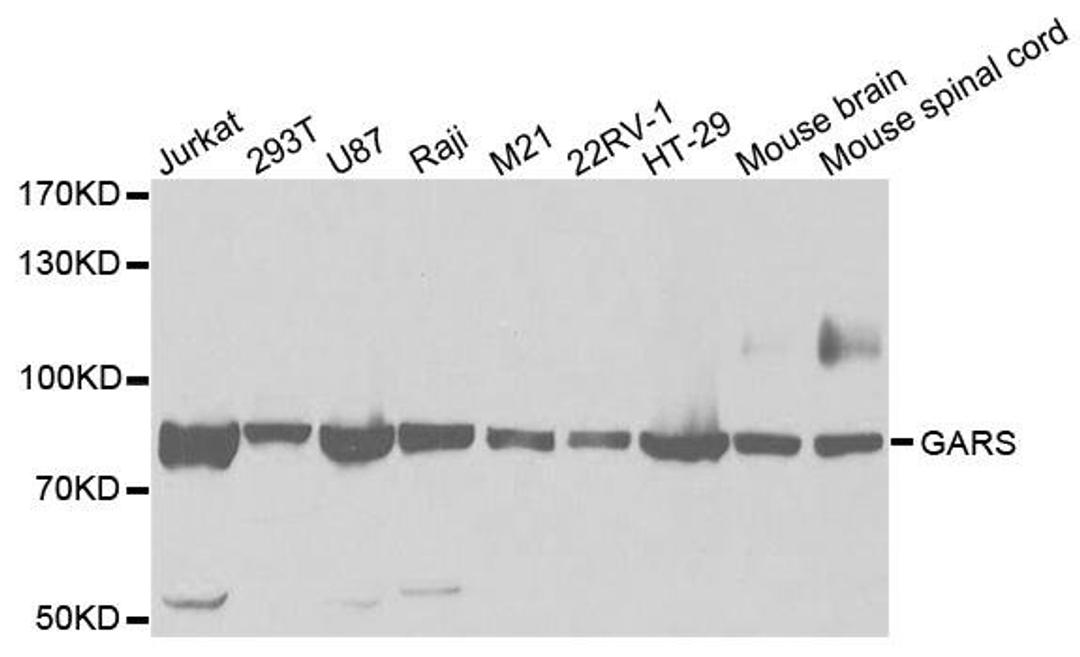 Western blot analysis of extracts of various cell lines using GARS antibody