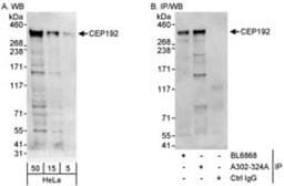 Detection of human CEP192 by western blot and immunoprecipitation.