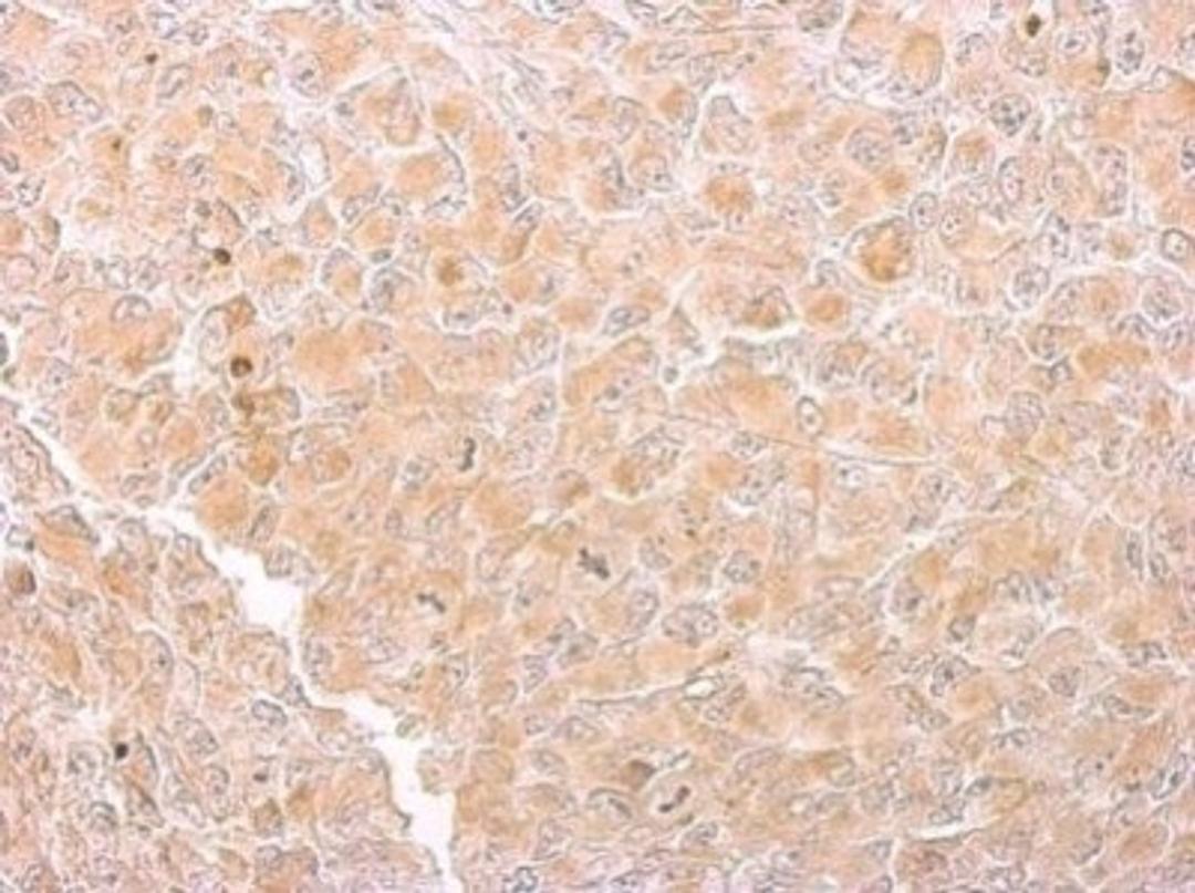 Immunohistochemistry-Paraffin: CS Citrate Synthase Antibody (1761) [NBP2-43648] - Analysis of H1299 xenograft. Citrate synthetase antibody dilution: 1:200.