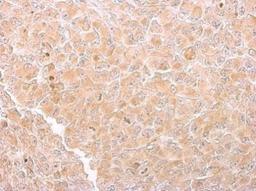 Immunohistochemistry-Paraffin: CS Citrate Synthase Antibody (1761) [NBP2-43648] - Analysis of H1299 xenograft. Citrate synthetase antibody dilution: 1:200.