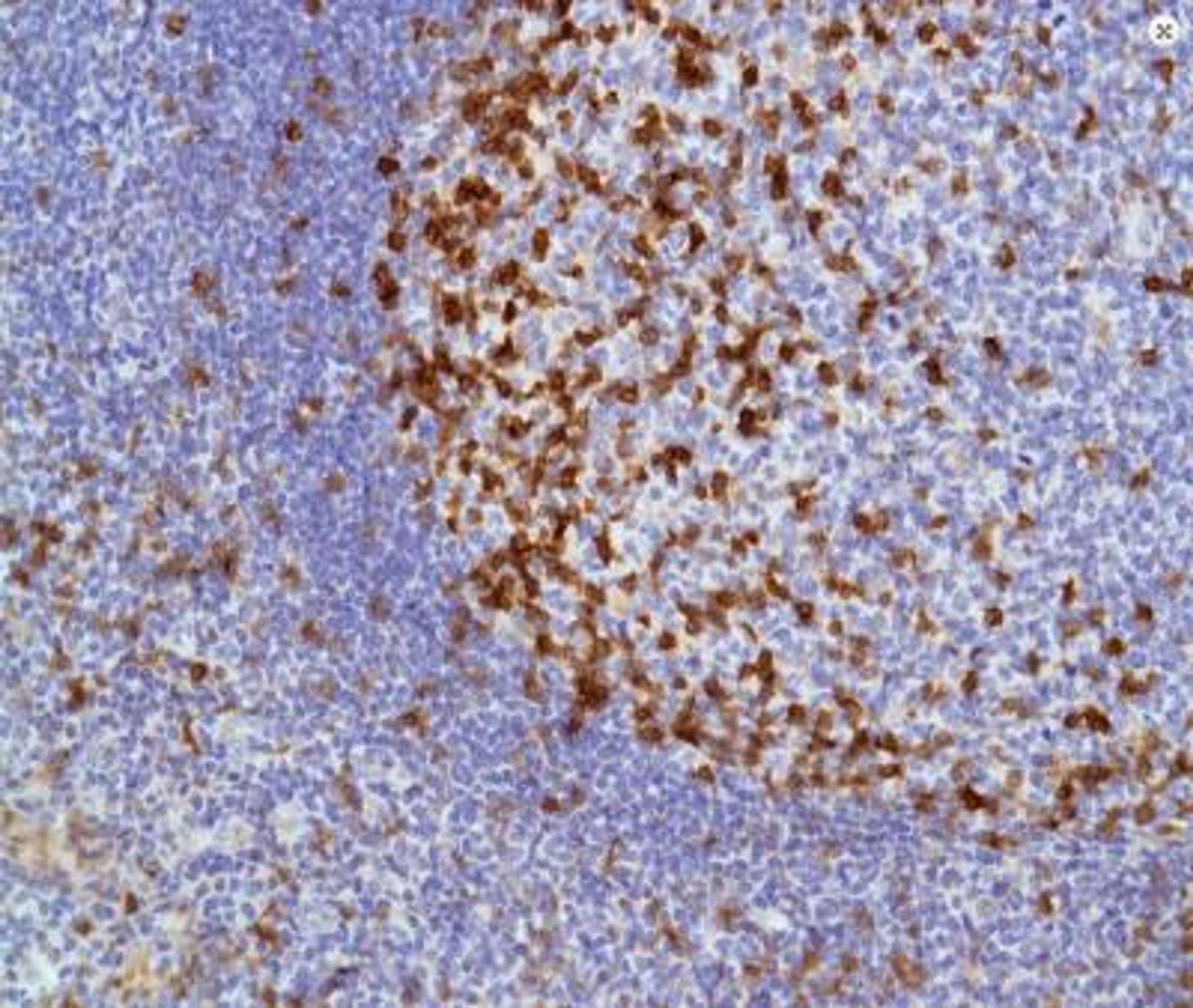 Immunohistochemistry-Paraffin: ICOS Antibody (SP98) [NBP2-12499] - Human Tonsil.