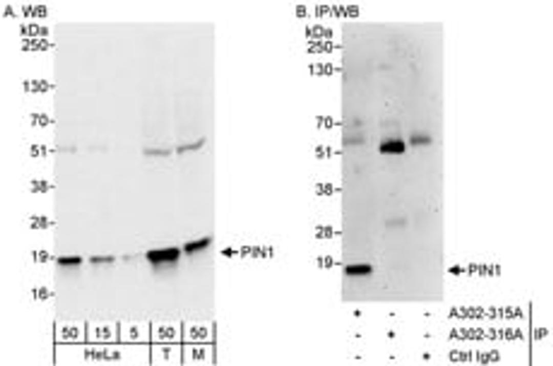 Detection of human and mouse PIN1 by western blot (h&m) and immunoprecipitation (h).