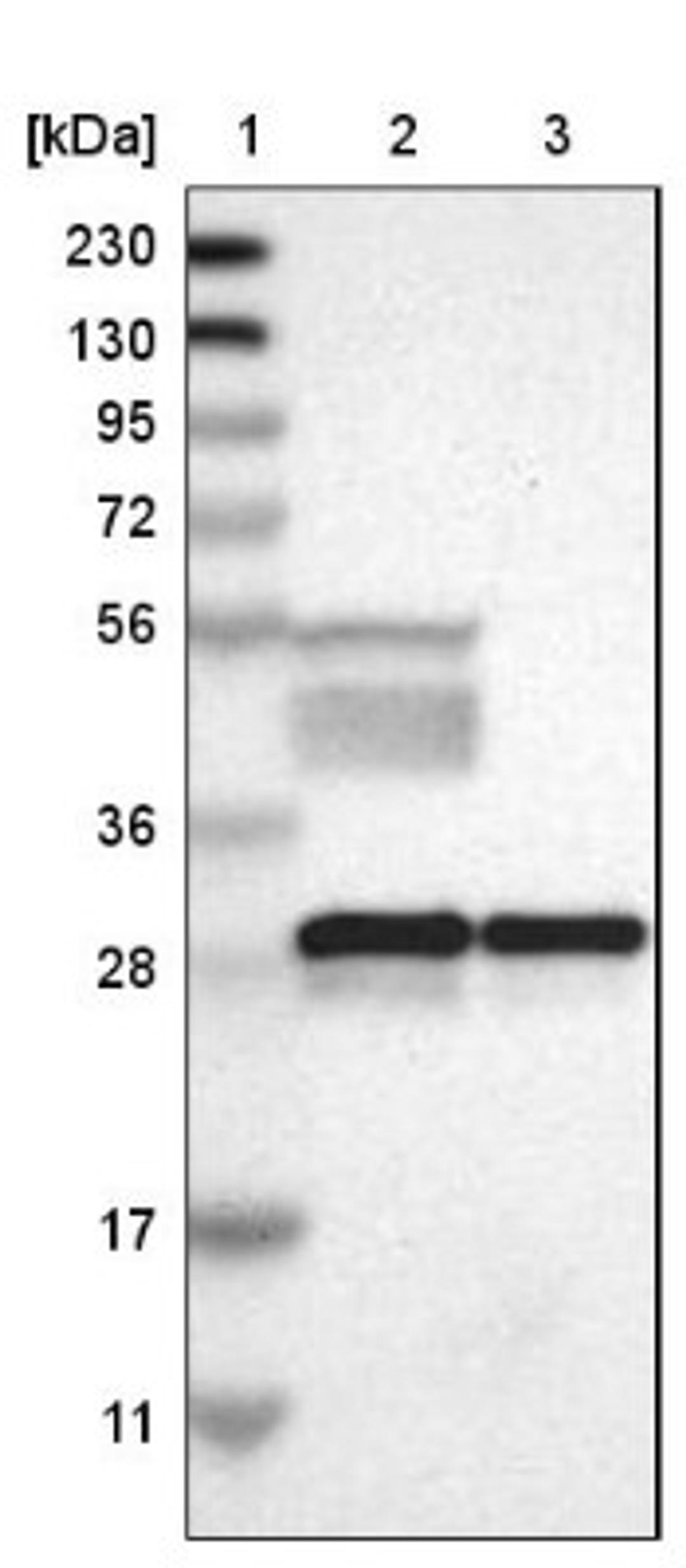 Western Blot: 14-3-3 beta/alpha Antibody [NBP1-80611] - Lane 1: Marker [kDa] 230, 130, 95, 72, 56, 36, 28, 17, 11<br/>Lane 2: Human cell line RT-4<br/>Lane 3: Human cell line U-251MG sp