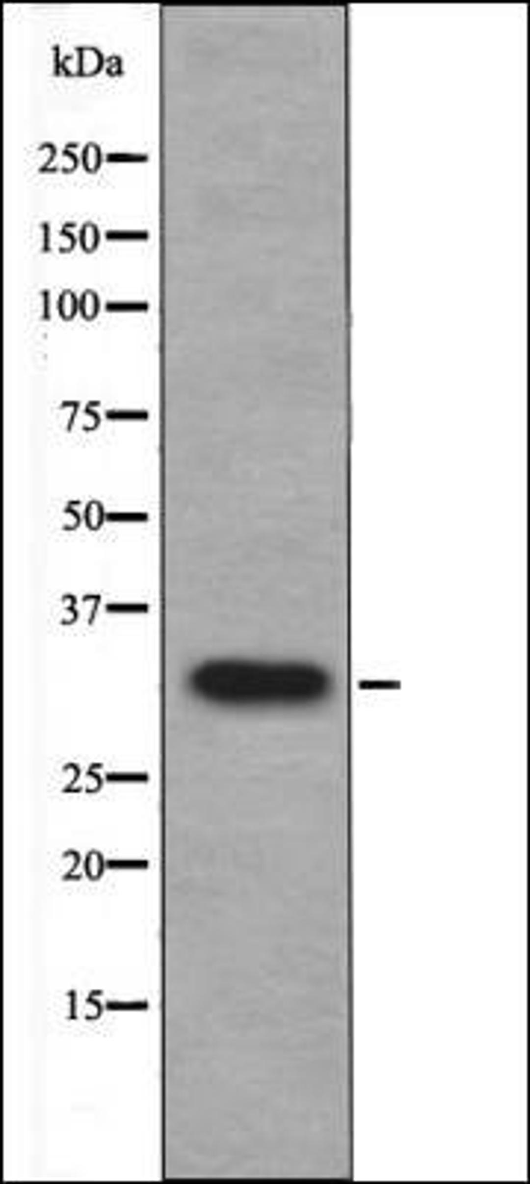 Western blot analysis of UV treated 293 whole cell lysates using Cyclin D1 -Phospho-Ser90- antibody