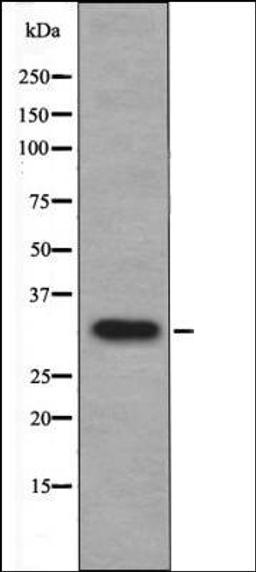 Western blot analysis of UV treated 293 whole cell lysates using Cyclin D1 -Phospho-Ser90- antibody