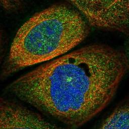 Immunocytochemistry/Immunofluorescence: URG4 Antibody [NBP1-87984] - Staining of human cell line A-431 shows positivity in cytoplasm & centrosome.