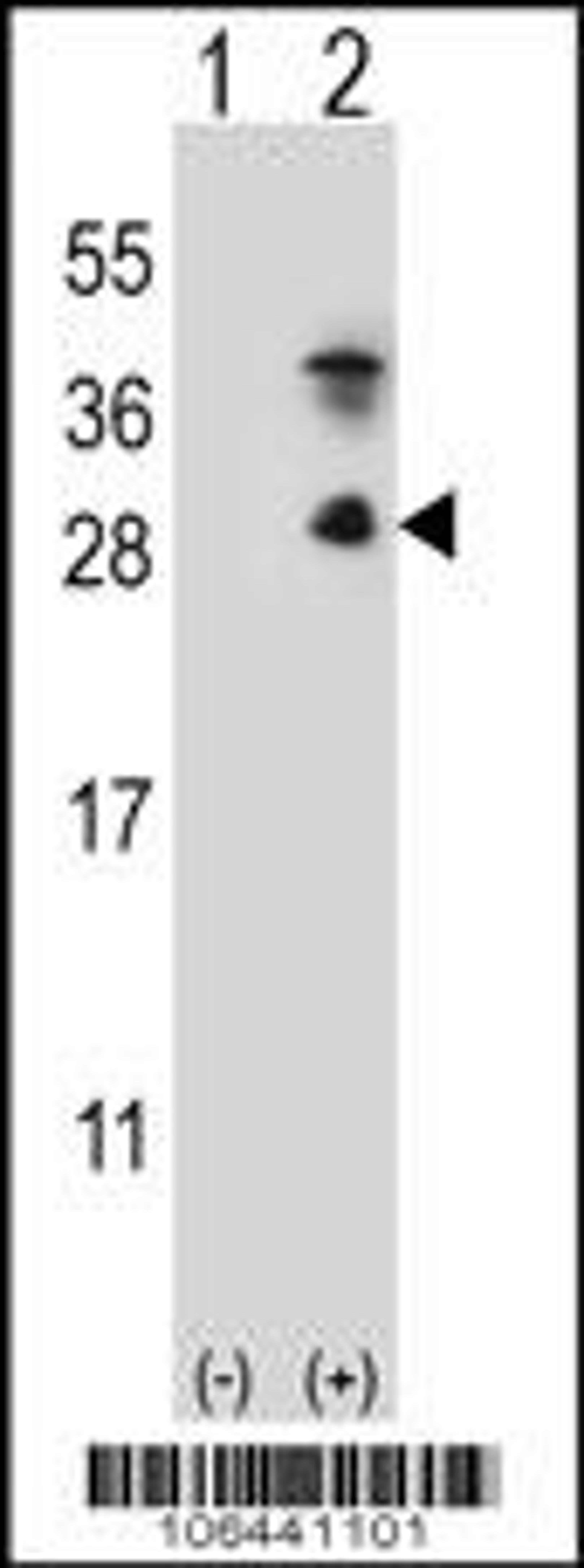 Western blot analysis of KLK7 using rabbit polyclonal KLK7 Antibody (S172) using 293 cell lysates (2 ug/lane) either nontransfected (Lane 1) or transiently transfected (Lane 2) with the KLK7 gene.