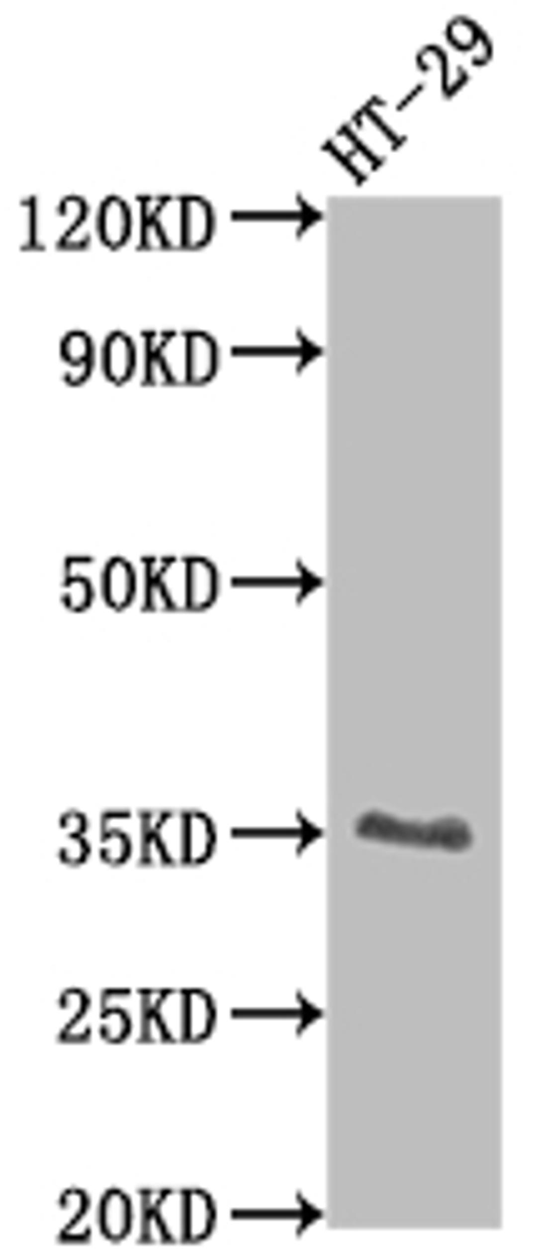Western Blot. Positive WB detected in: HT-29 whole cell lysate. All lanes: EPCAM antibody at 1:2000. Secondary. Goat polyclonal to rabbit IgG at 1/50000 dilution. Predicted band size: 35 kDa. Observed band size: 35 kDa. 