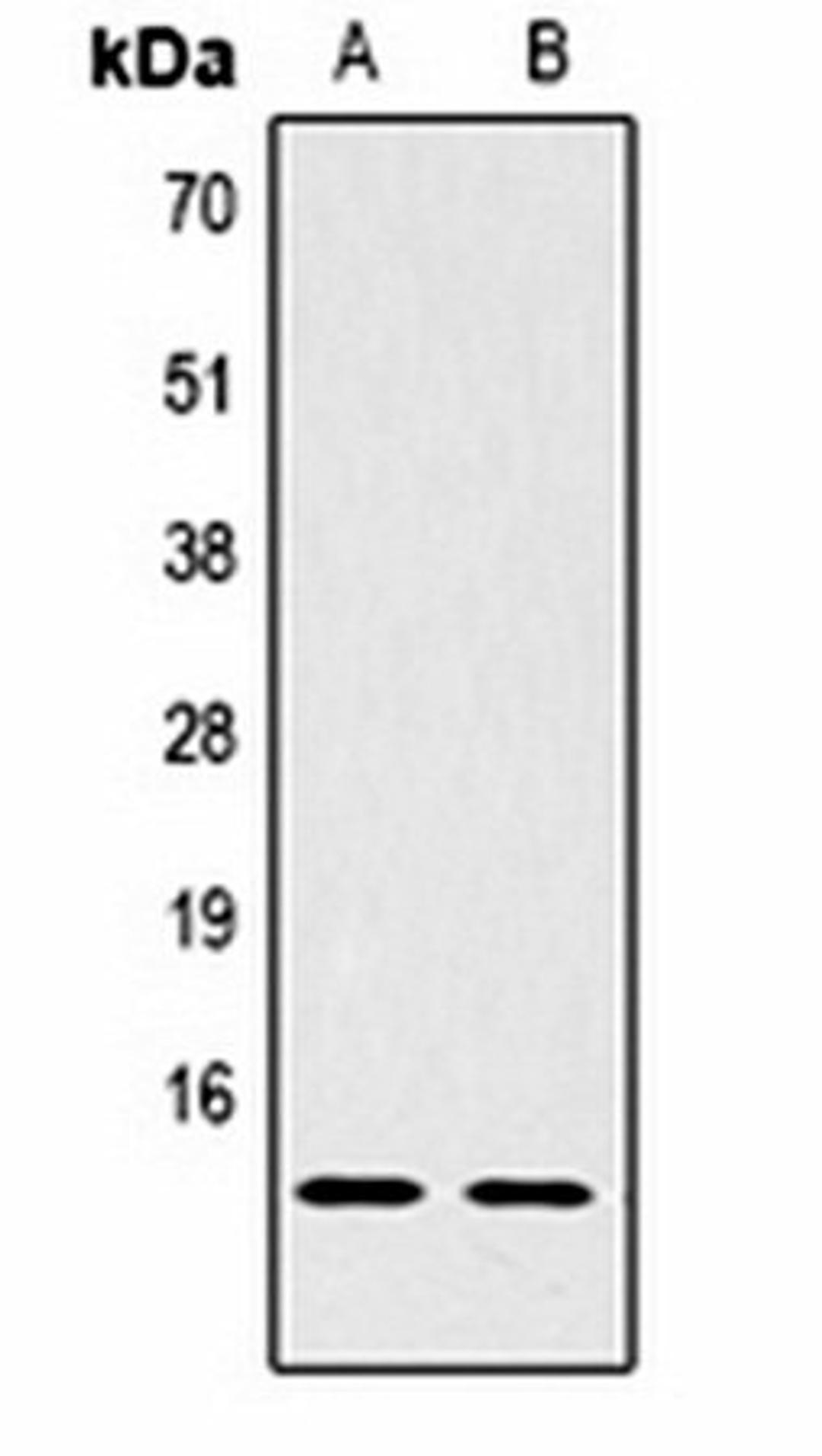 Western blot analysis of Hela (Lane1), NIH3T3 (Lane2) whole cell lysates using Histone H2B (DiMethyl K43) antibody