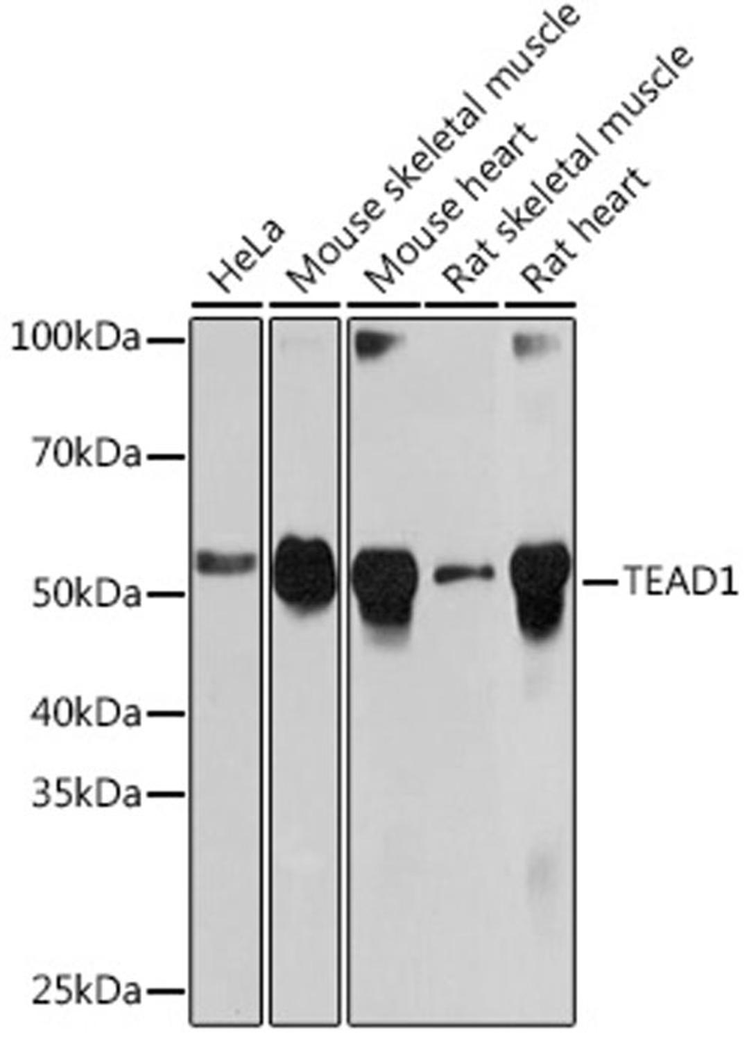 Western blot - TEAD1 Rabbit mAb (A5218)