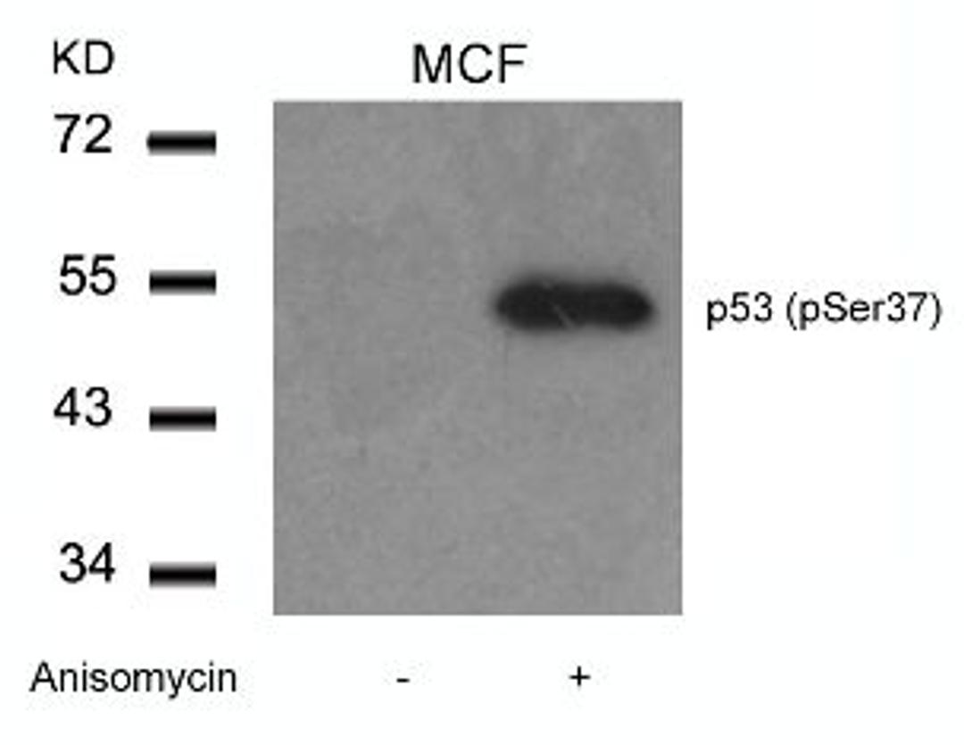 Western blot analysis of lysed extracts from MCF cells untreated or treated with Anisomycin using p53 (Phospho-Ser37).