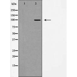 Western blot analysis of mouse brain using GluR2/3 antibody