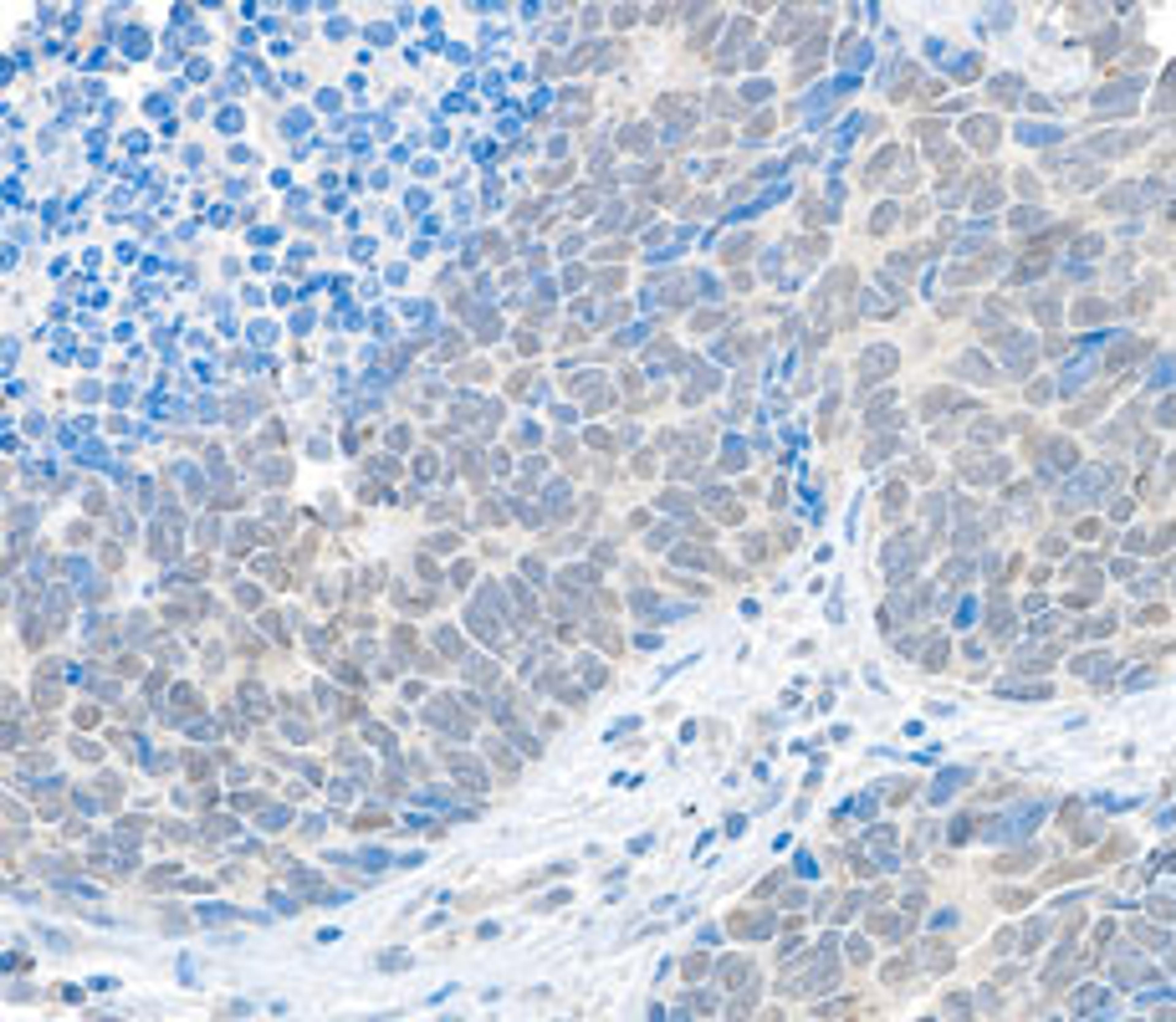 Detection of human USP37 by immunohistochemistry.