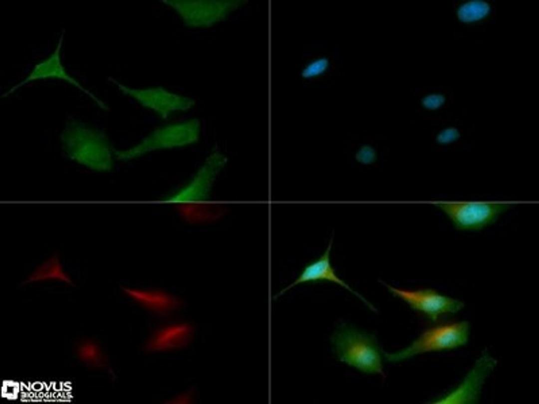 Immunocytochemistry/Immunofluorescence: LC3/MAP1LC3A Antibody [NB100-2331] - LC3 antibody was tested in HeLa cells with Dylight 488 (green). Nuclei and alpha-tubulin were counterstained with DAPI (blue) and Dylight 550 (red).