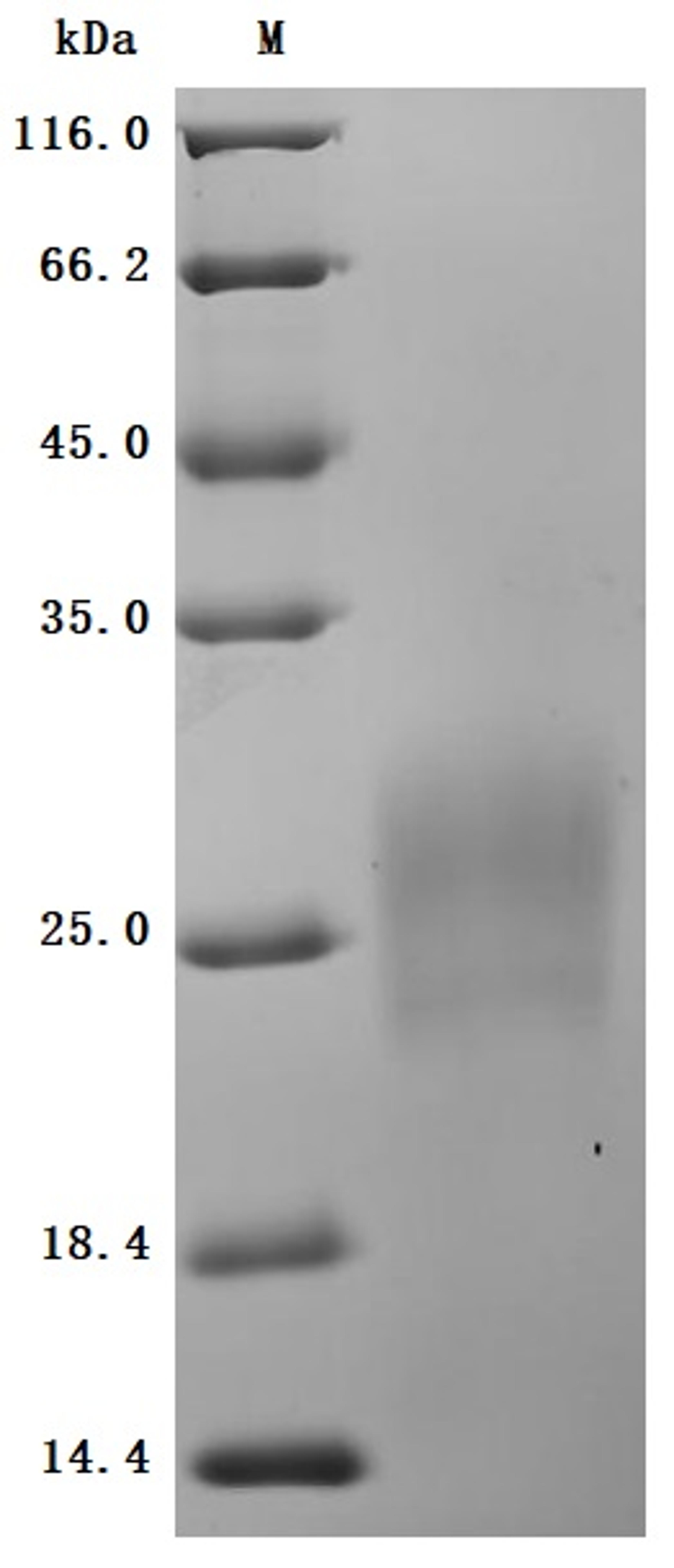 (Tris-Glycine gel) Discontinuous SDS-PAGE (reduced) with 5% enrichment gel and 15% separation gel.