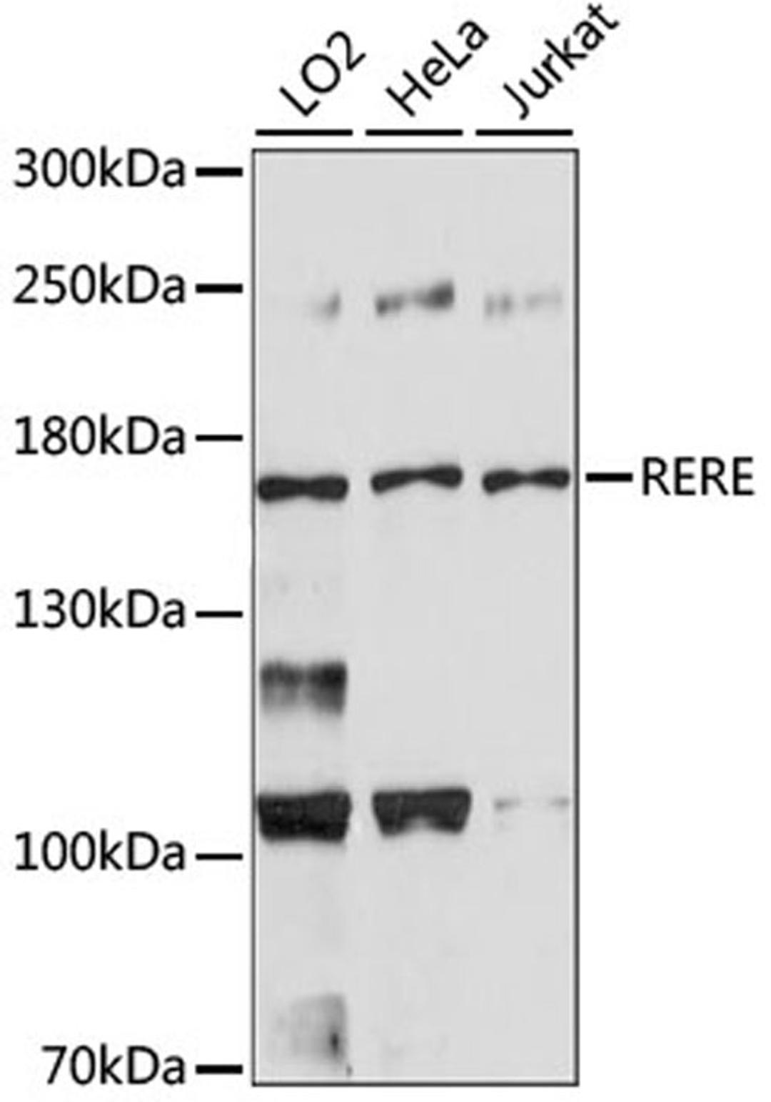 Western blot - RERE antibody (A15255)