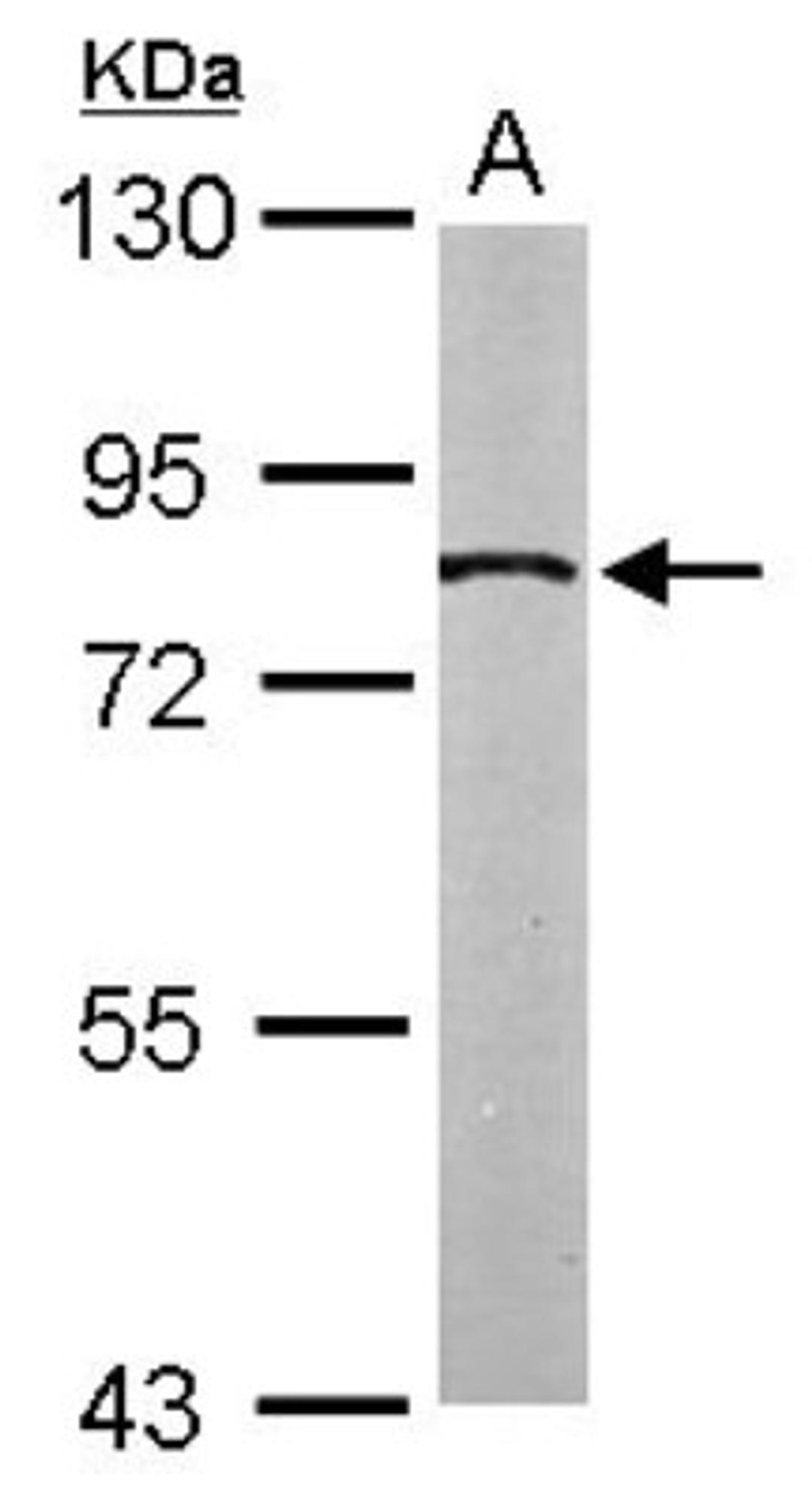 Western Blot: SLC20A1 Antibody [NBP1-32252] - Sample (50 ug of whole cell lysate) A: Mouse brain 7. 5% SDS PAGE; antibody diluted at 1:1000.