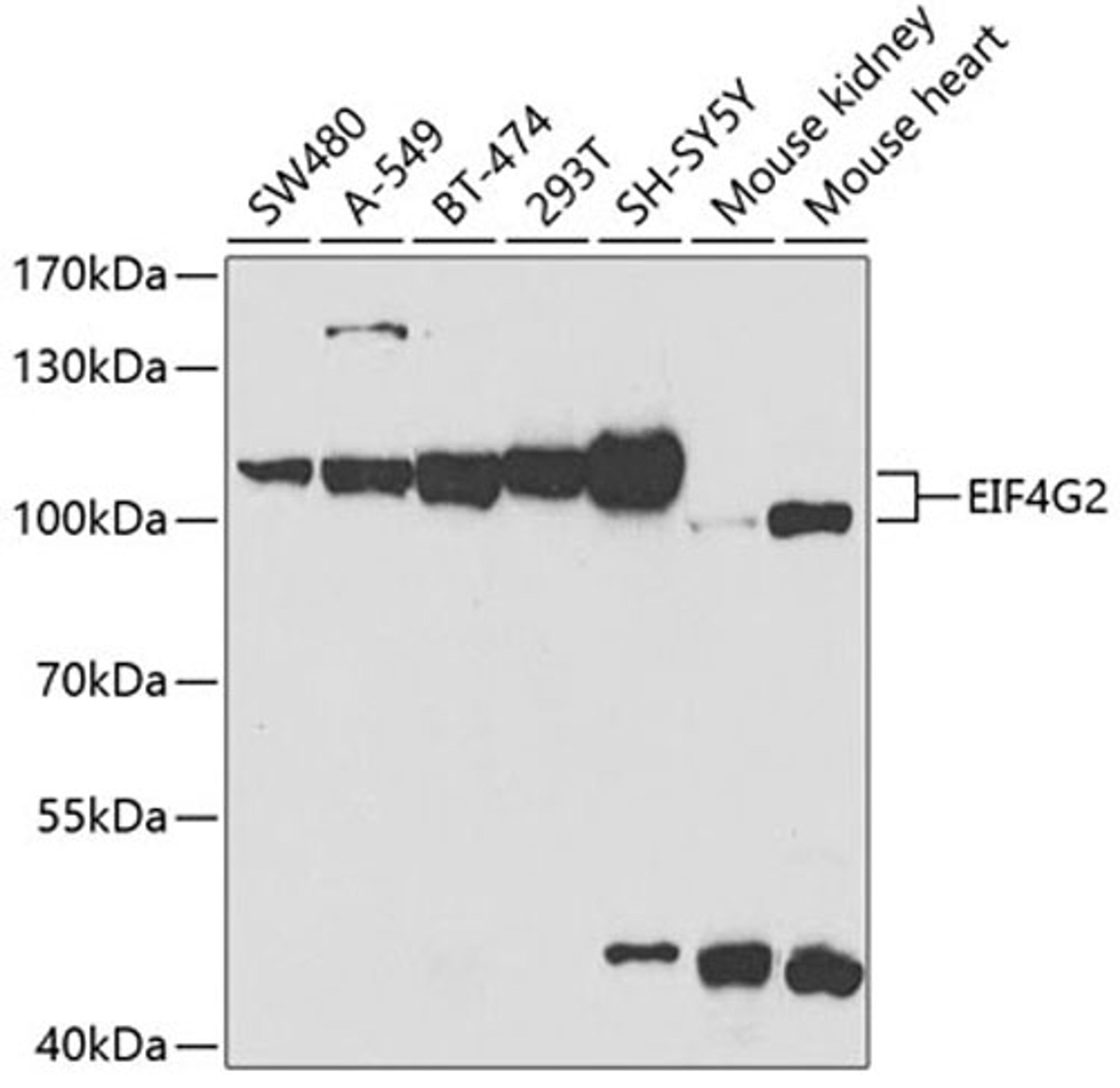 Western blot - EIF4G2 antibody (A2897)