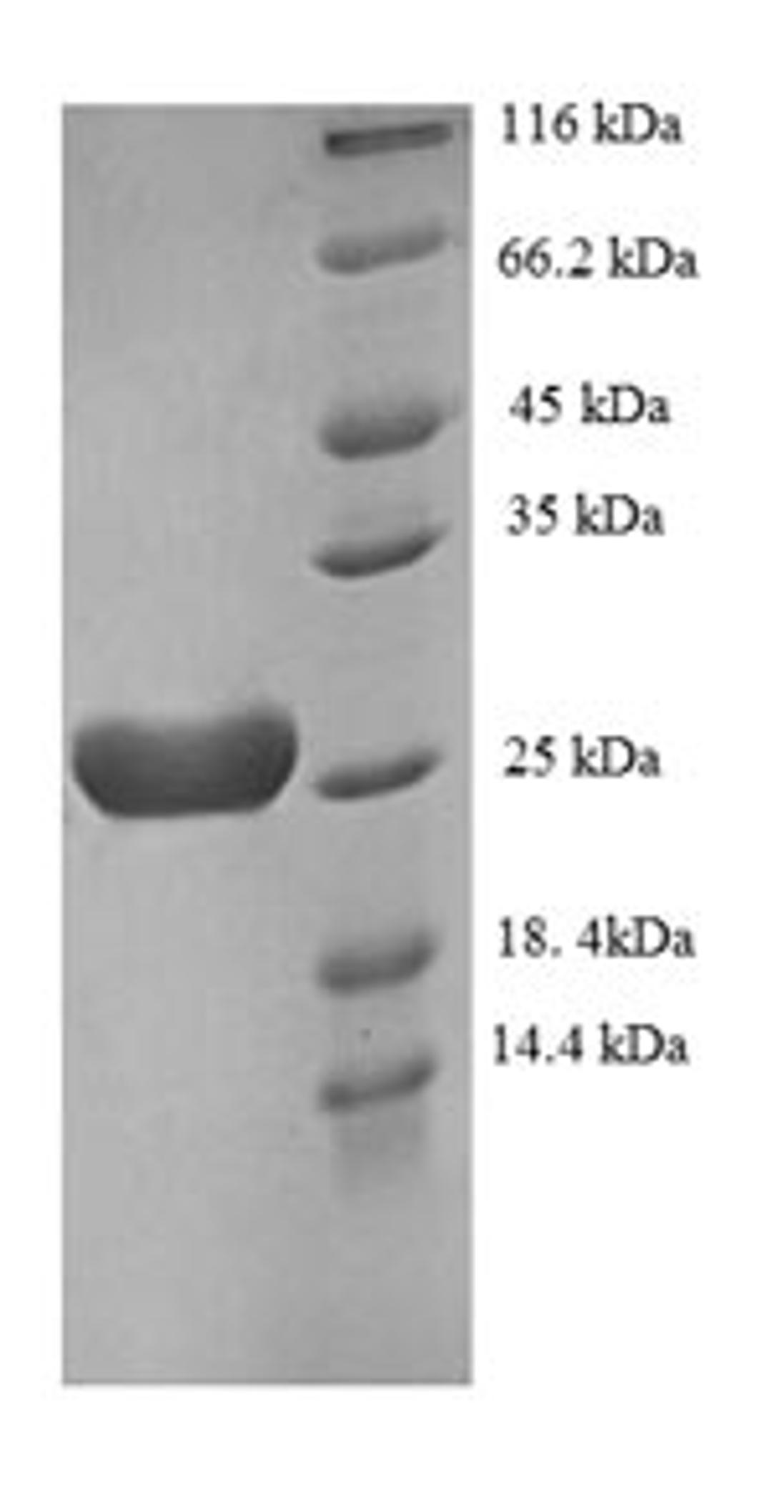 (Tris-Glycine gel) Discontinuous SDS-PAGE (reduced) with 5% enrichment gel and 15% separation gel.
