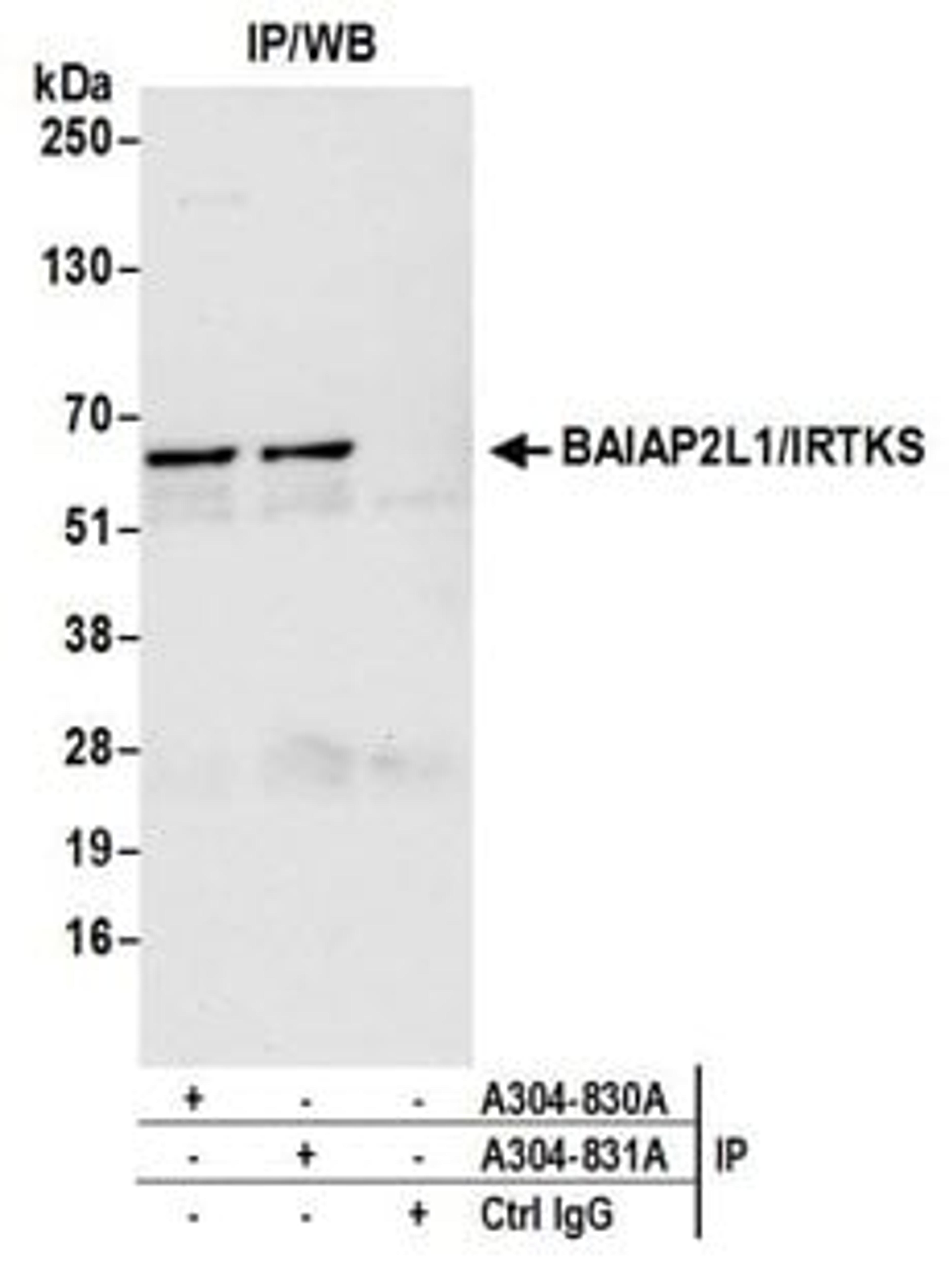 Detection of human BAIAP2L1/IRTKS by western blot of immunoprecipitates.