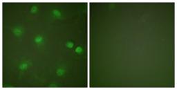 Immunocytochemistry/Immunofluorescence: MEF2A Antibody [NBP1-61205] - Analysis of HeLa cells, using MEF2A  Antibody. The picture on the right is treated with the synthesized peptide.