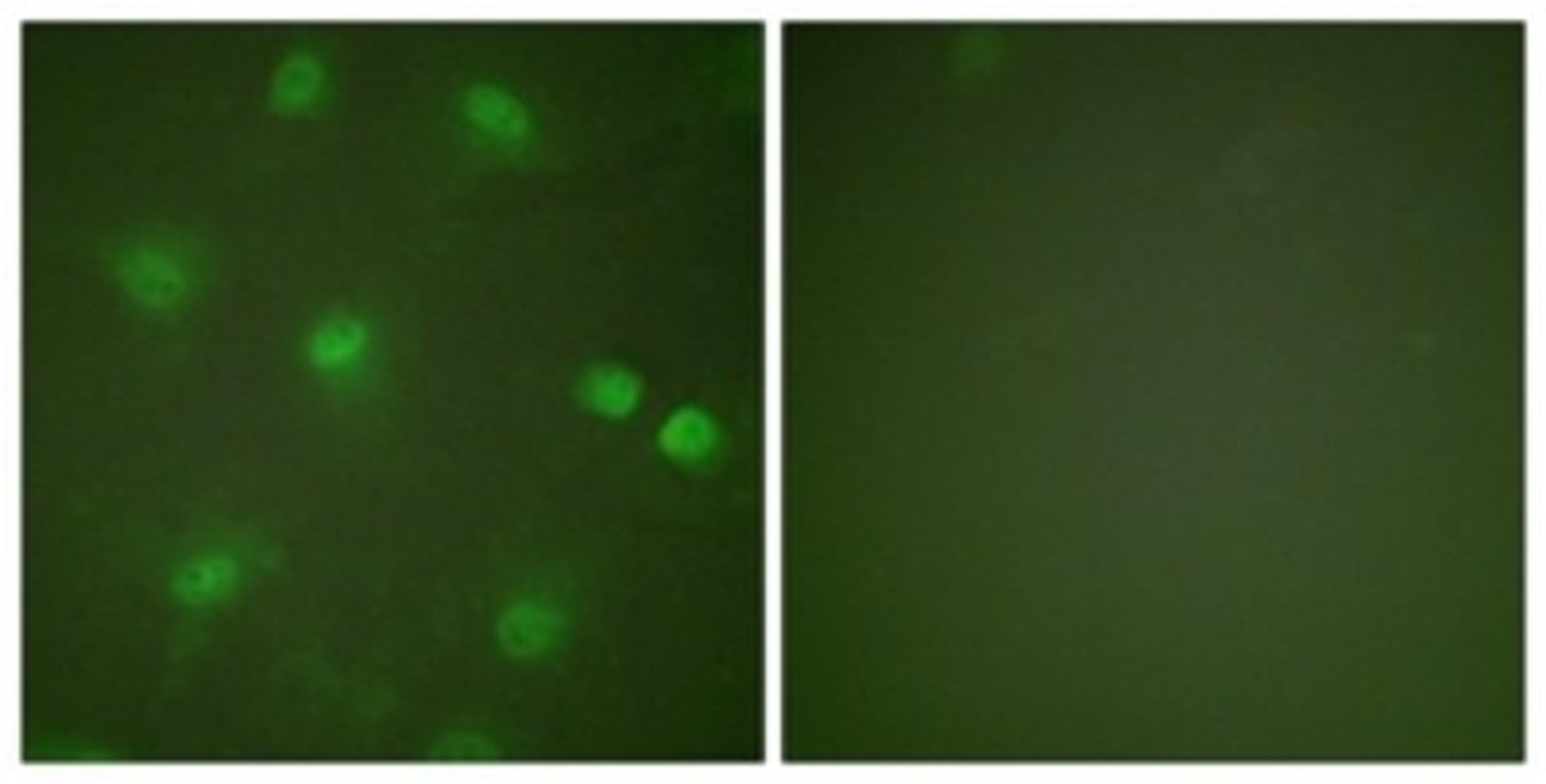 Immunocytochemistry/Immunofluorescence: MEF2A Antibody [NBP1-61205] - Analysis of HeLa cells, using MEF2A  Antibody. The picture on the right is treated with the synthesized peptide.