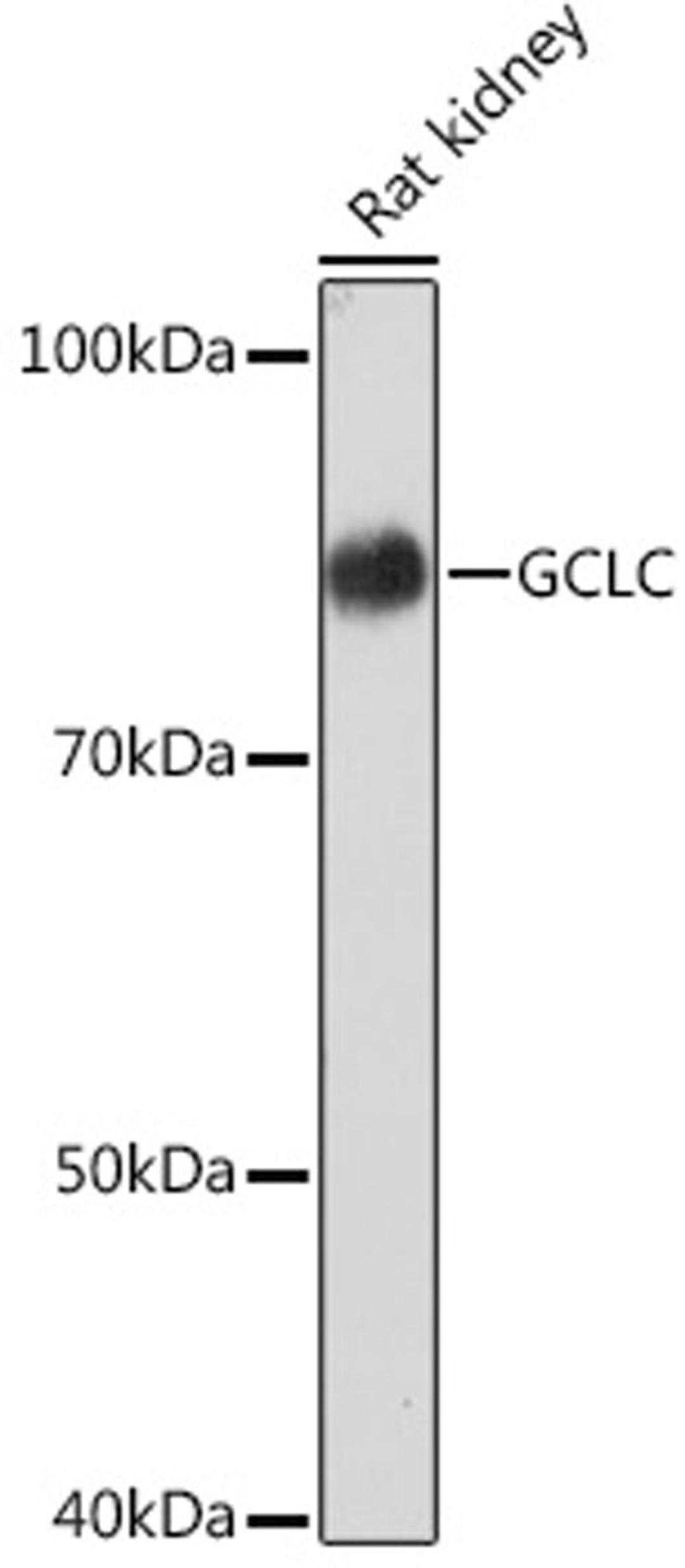 Western blot - GCLC Rabbit mAb (A4499)