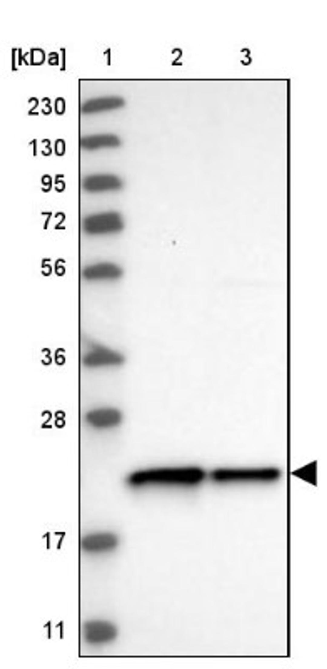 Western Blot: c-Myc-responsive protein Rcl Antibody [NBP1-85180] - Lane 1: Marker [kDa] 230, 130, 95, 72, 56, 36, 28, 17, 11<br/>Lane 2: Human cell line RT-4<br/>Lane 3: Human cell line U-251MG sp