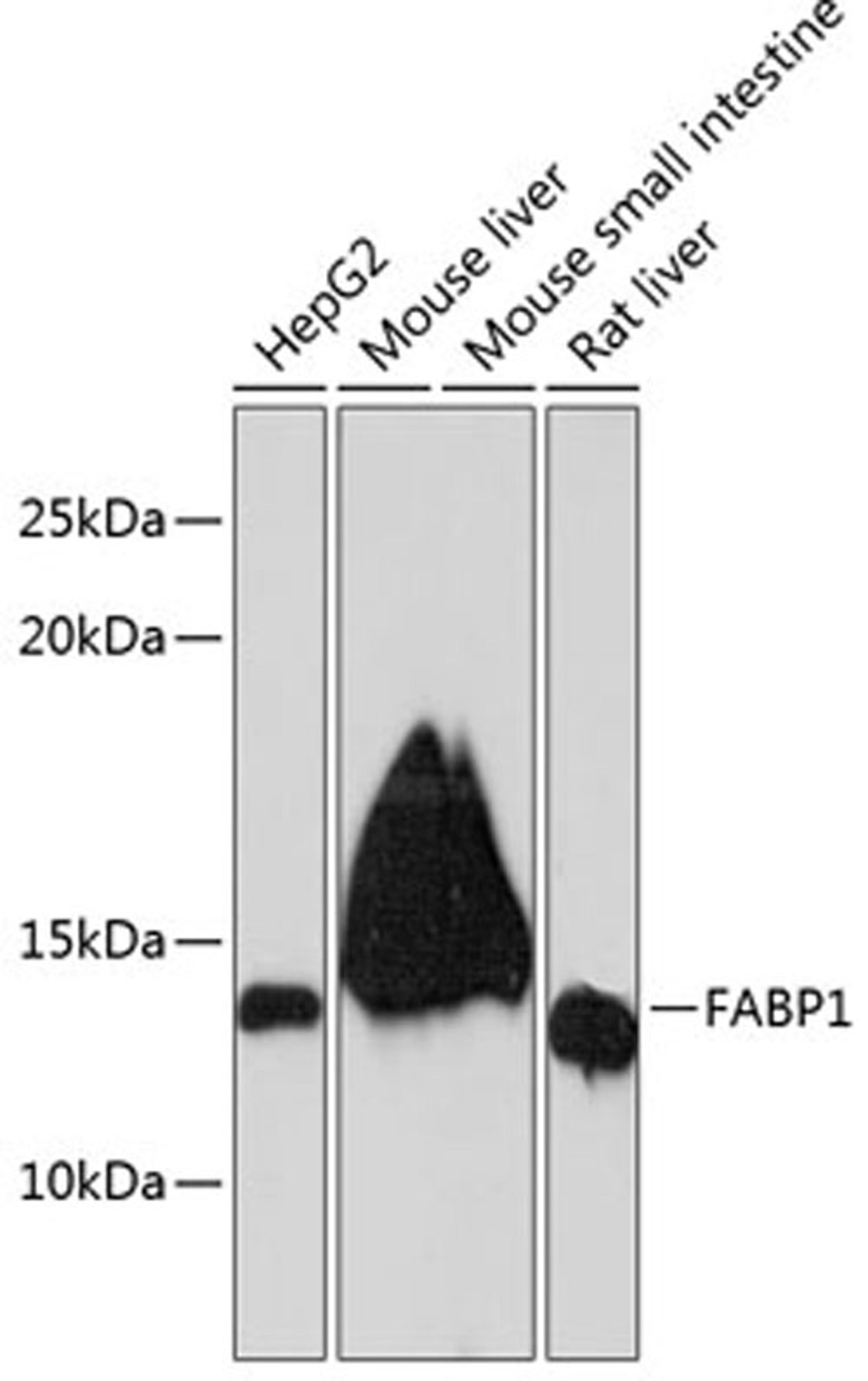 Western blot - FABP1 Rabbit mAb (A11213)