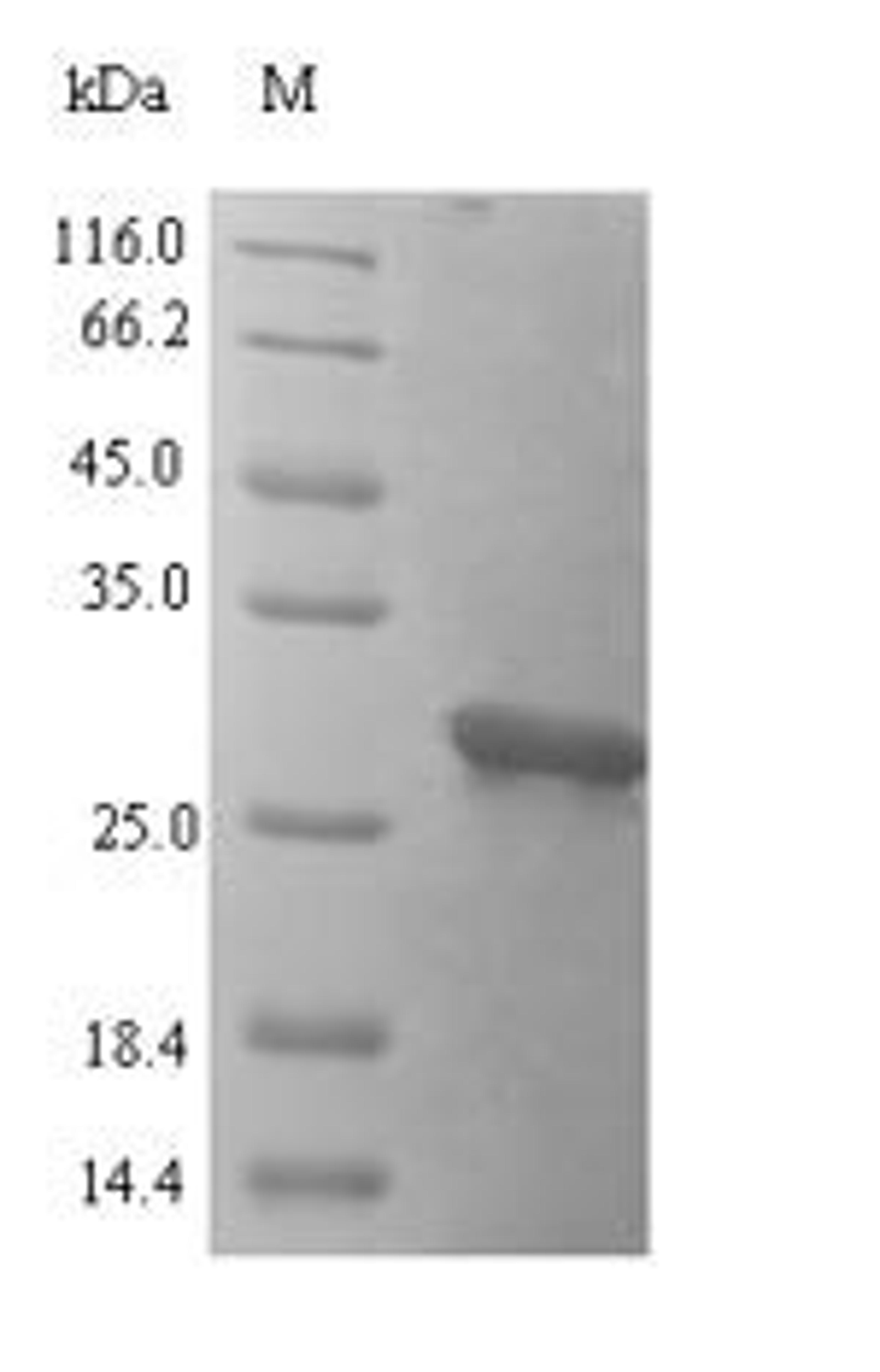 (Tris-Glycine gel) Discontinuous SDS-PAGE (reduced) with 5% enrichment gel and 15% separation gel.