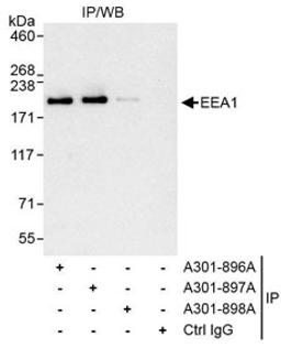 Detection of human EEA1 by western blot of immunoprecipitates.