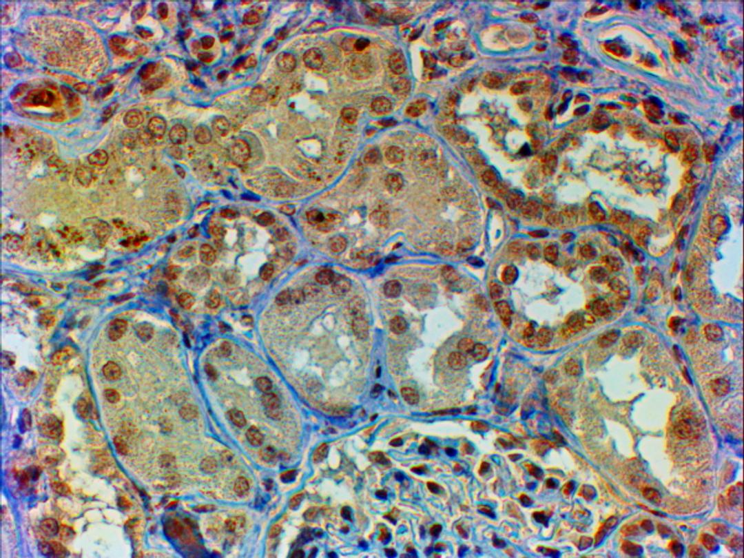 45-922 (2ug/ml) staining of paraffin embedded Human Kidney. Steamed antigen retrieval with citrate buffer pH 6, HRP-staining.