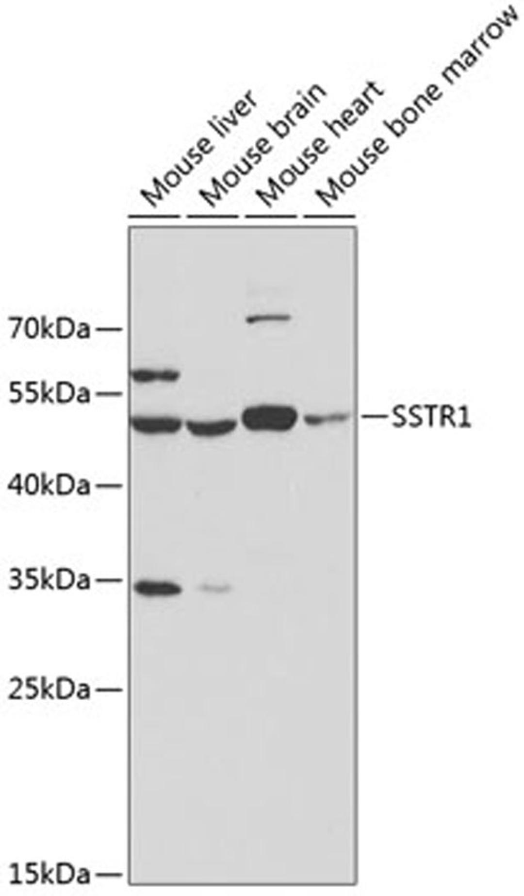 Western blot - SSTR1 antibody (A3134)