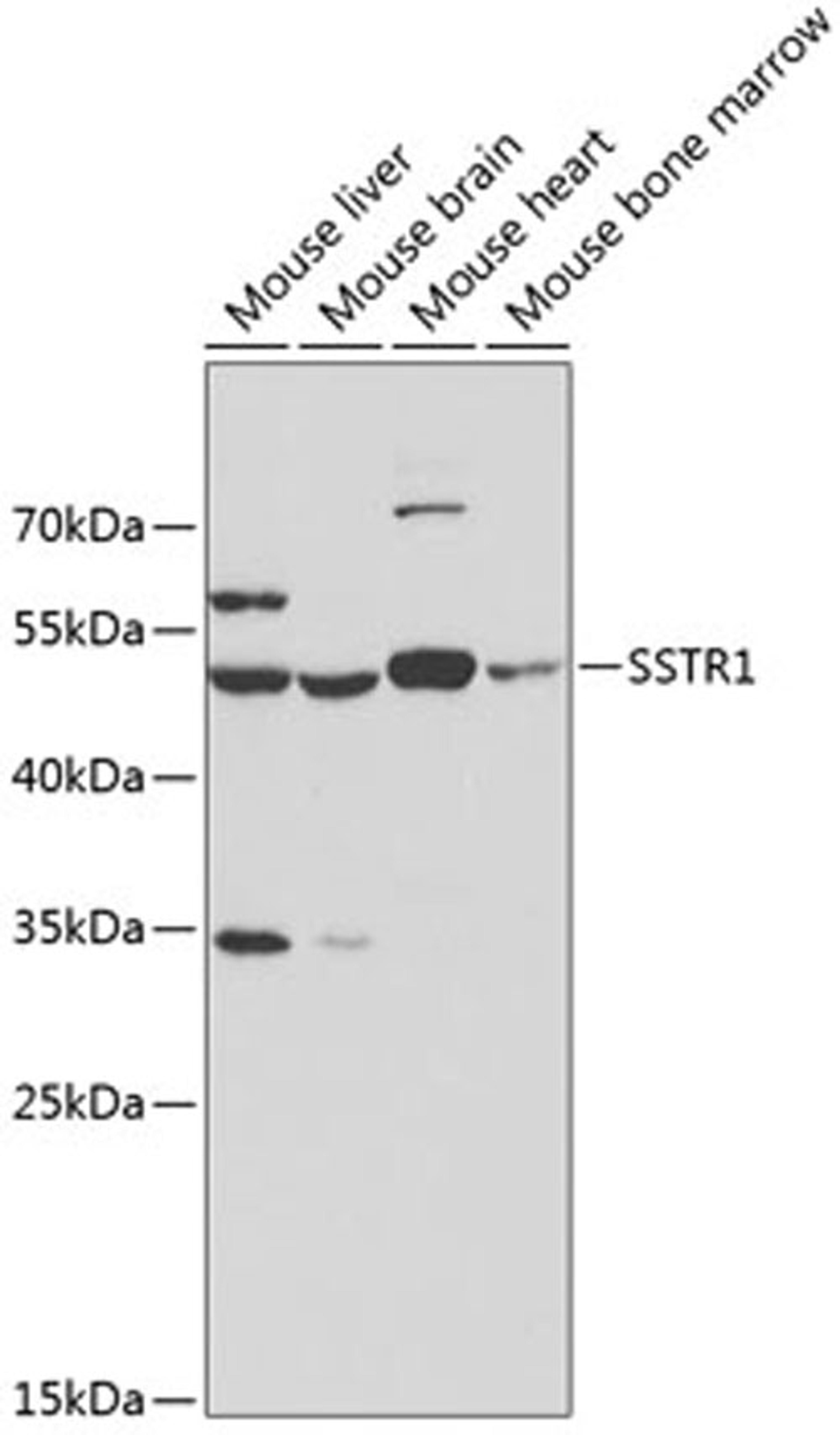 Western blot - SSTR1 antibody (A3134)