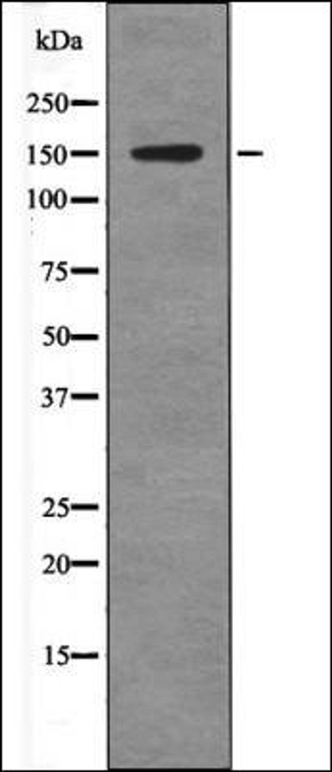 Western blot analysis of COLO205 whole cell lysates using Claspin -Phospho-Ser30- antibody