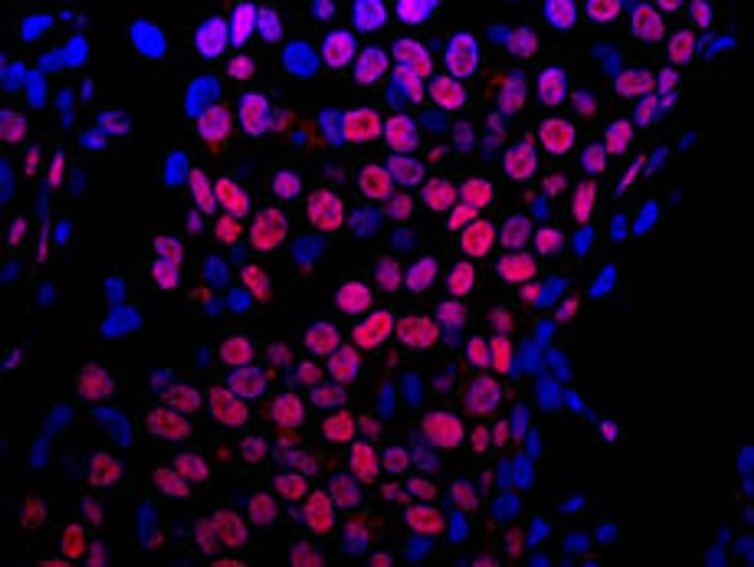 Detection of human E1B-AP5 by immunohistochemistry.