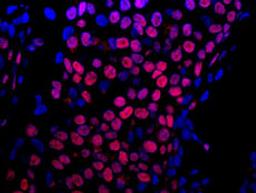 Detection of human E1B-AP5 by immunohistochemistry.