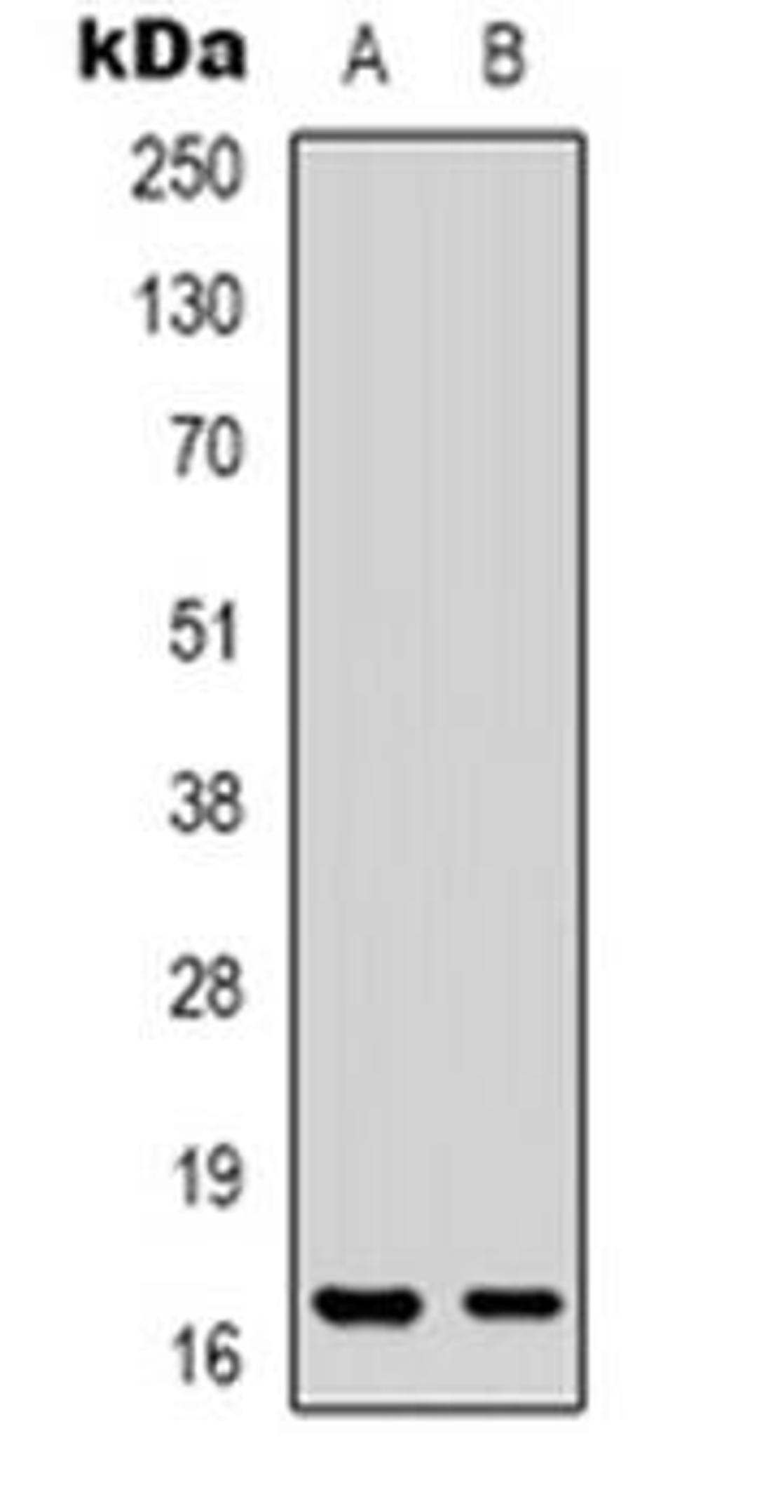 Western blot analysis of CPI17 expression in Jurkat (Lane 1), HT29 (Lane 2) whole cell lysates using PPP1R14A antibody