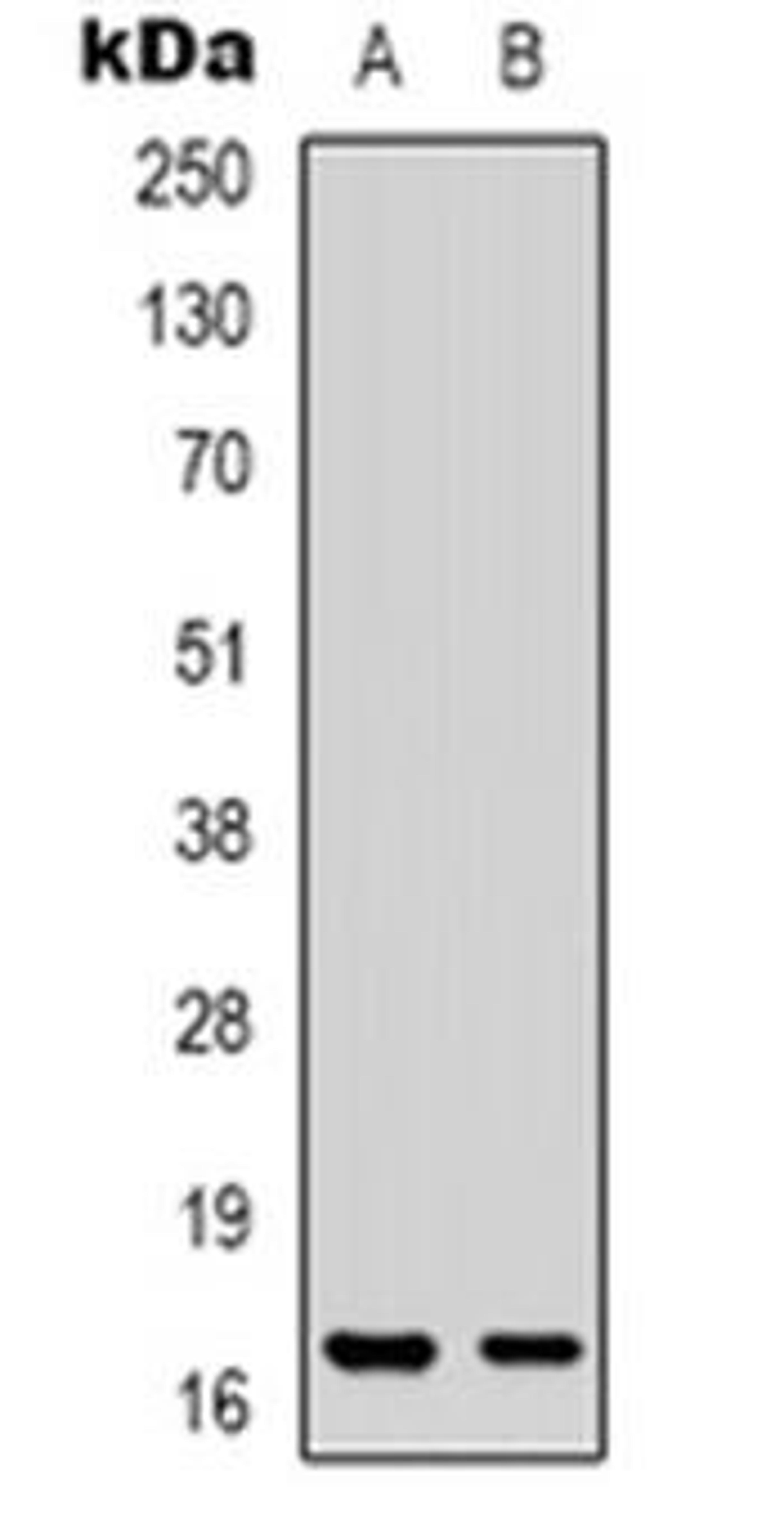 Western blot analysis of CPI17 expression in Jurkat (Lane 1), HT29 (Lane 2) whole cell lysates using PPP1R14A antibody