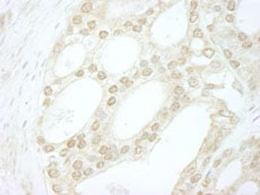 Detection of human B-Myb by immunohistochemistry.