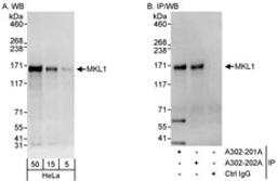 Detection of human MKL1 by western blot and immunoprecipitation.